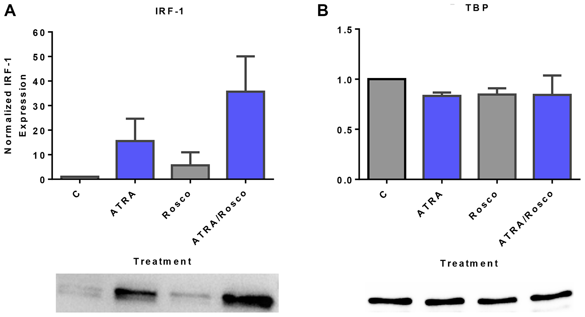 Roscovitine enhances ATRA-induced nuclear enrichment of IRF-1