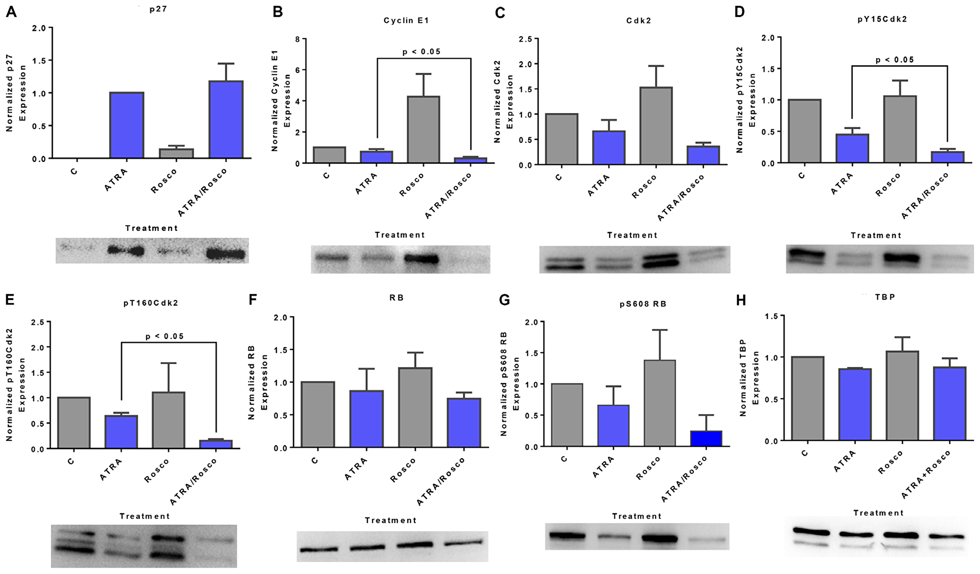 Roscovitine effects on ATRA-induced changes in nuclear expression of G1/G0 regulatory molecules: p27/cyclin E1/Cdk2/RB pathway