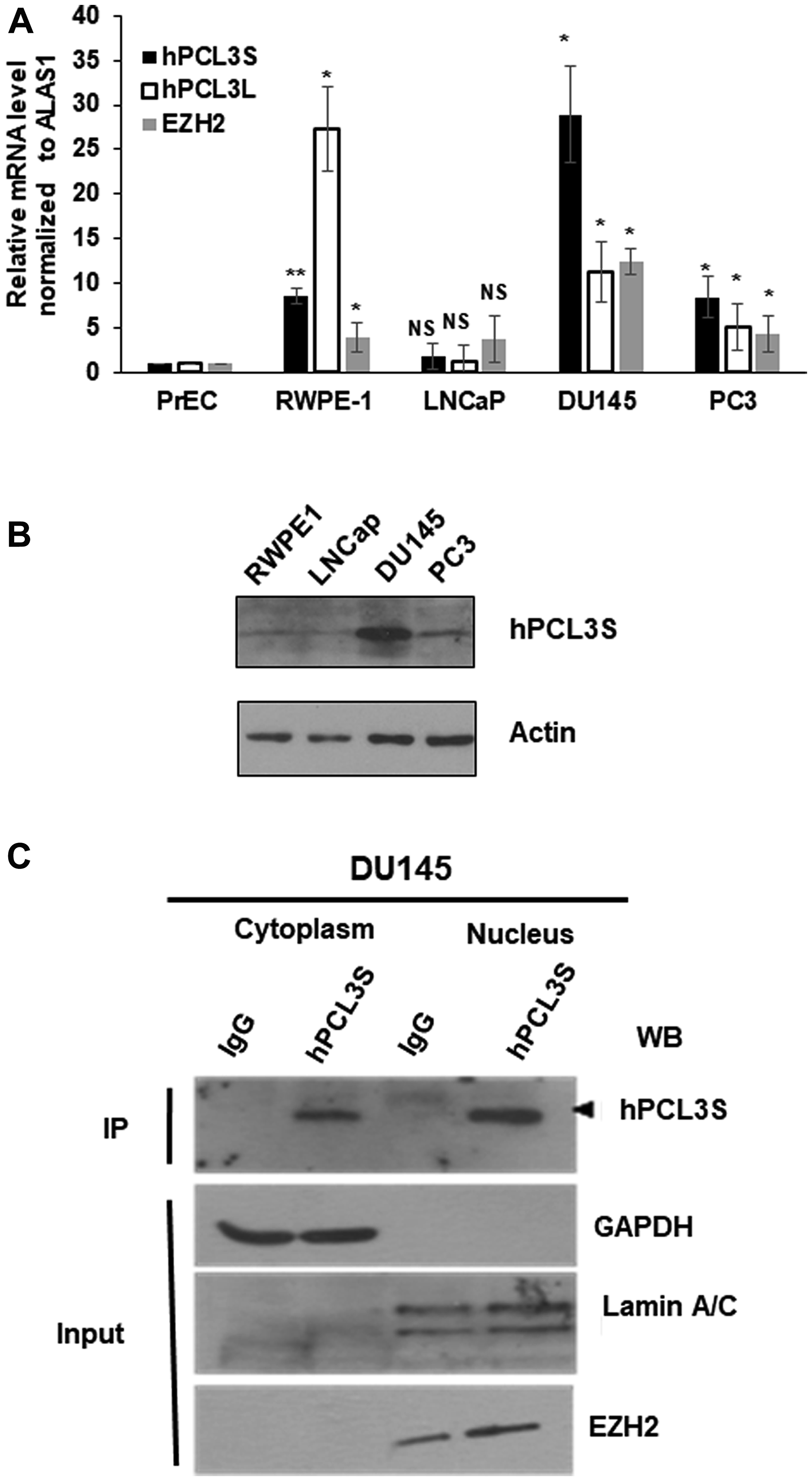 hPCL3S expression is specifically elevated in androgeno-negative prostate cancer cells, in vitro