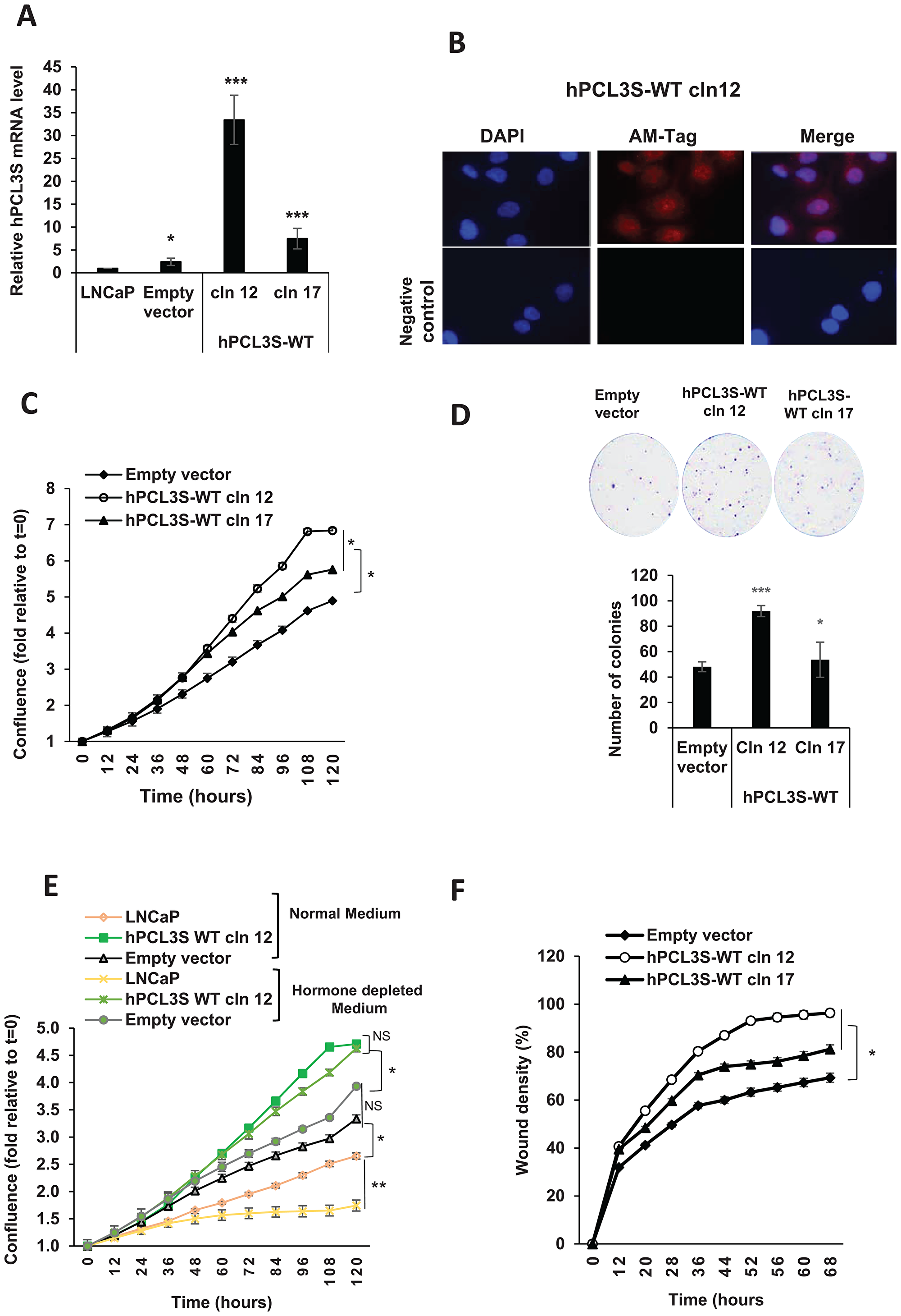 hPCL3S promotes proliferation and migration in the androgeno-dependent human prostate cancer cells, LNCaP