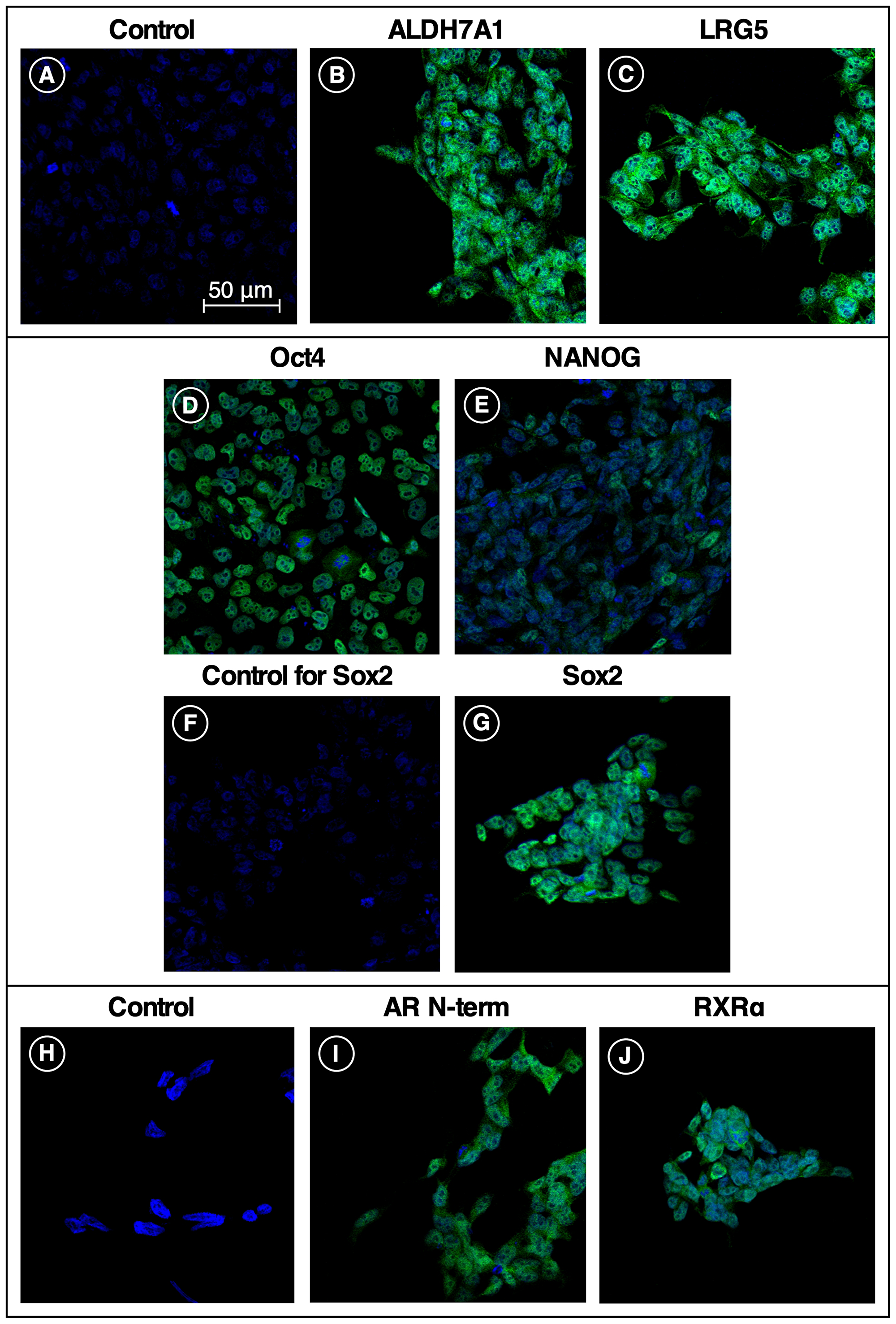 Stem cell and receptor markers expressed in iPS87 cells