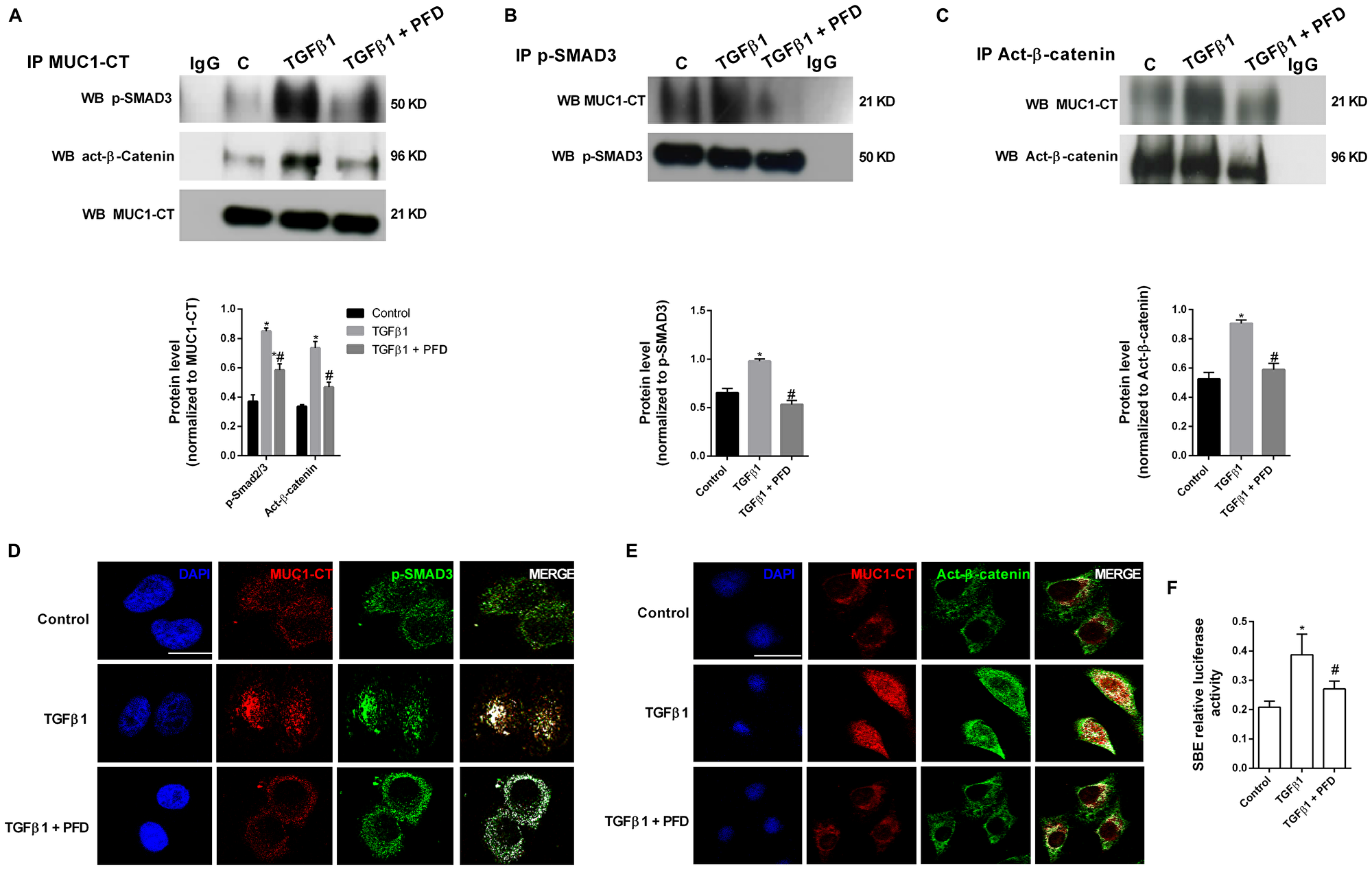 Pirfenidone (PFD) inhibits MUC1-CT co-localization with phospho (p)-Smad3 and active (act)-β-catenin in the nuclei of alveolar epithelial type II (ATII) cells stimulated with TGFβ1