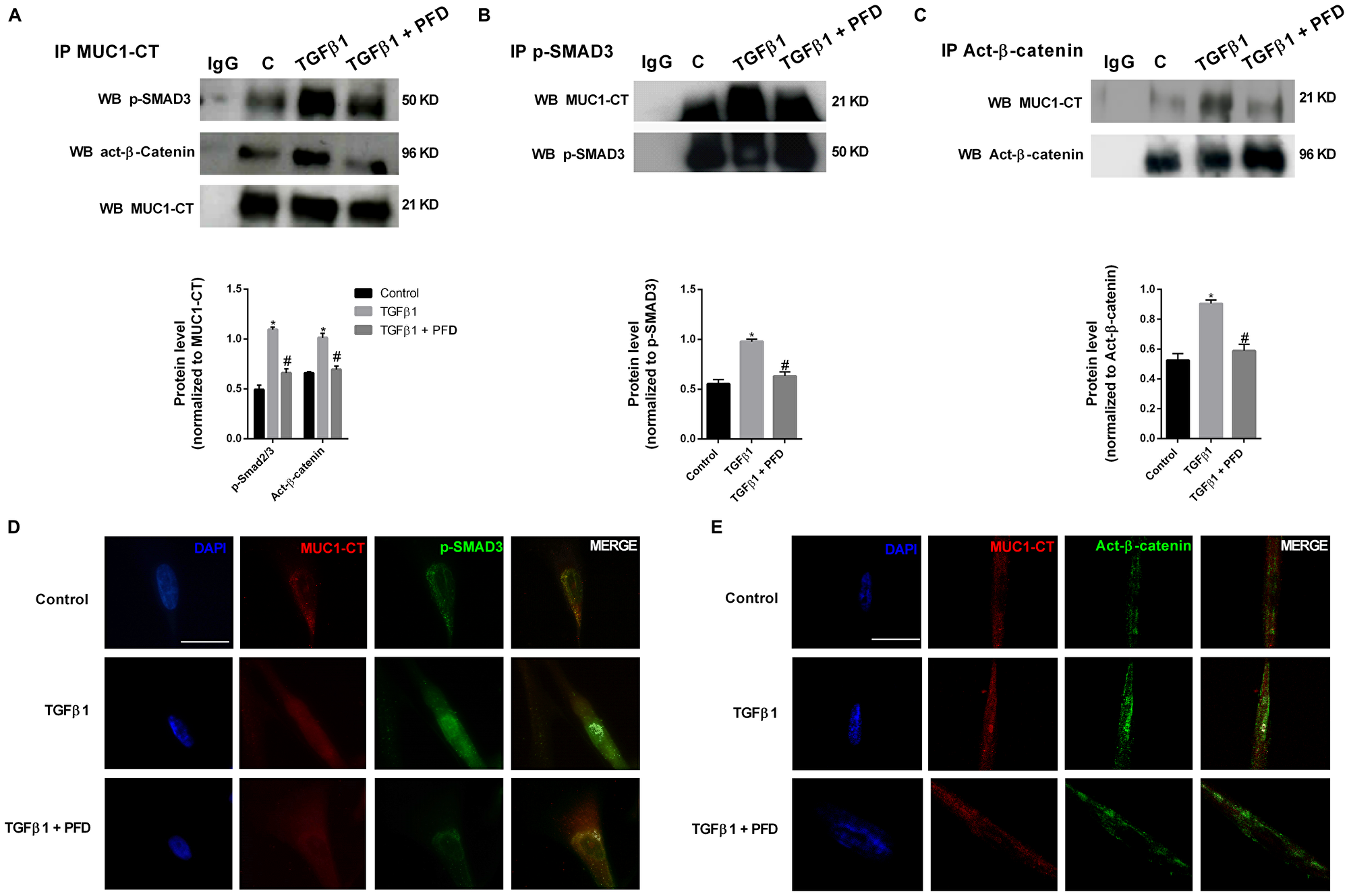 Pirfenidone (PFD) inhibits MUC1-CT co-localization with pSmad3 and active-β-catenin in the nuclei of lung fibroblasts stimulated with TGFβ1