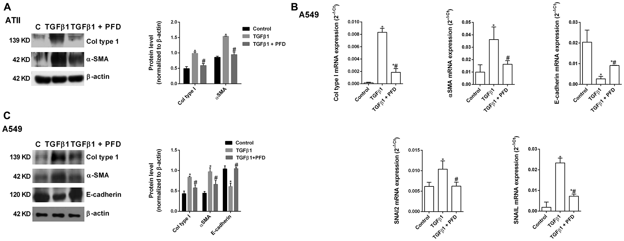 Pirfenidone (PFD) inhibits the TGF-β1-induced alveolar type II (ATII) to mesenchymal transition