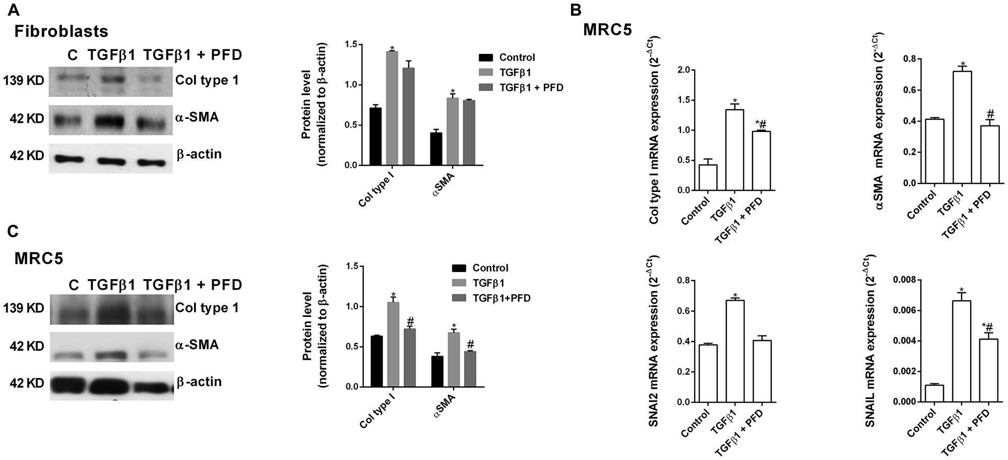 Pirfenidone (PFD) inhibits the TGF-β1-induced fibroblast to myofibroblast transition