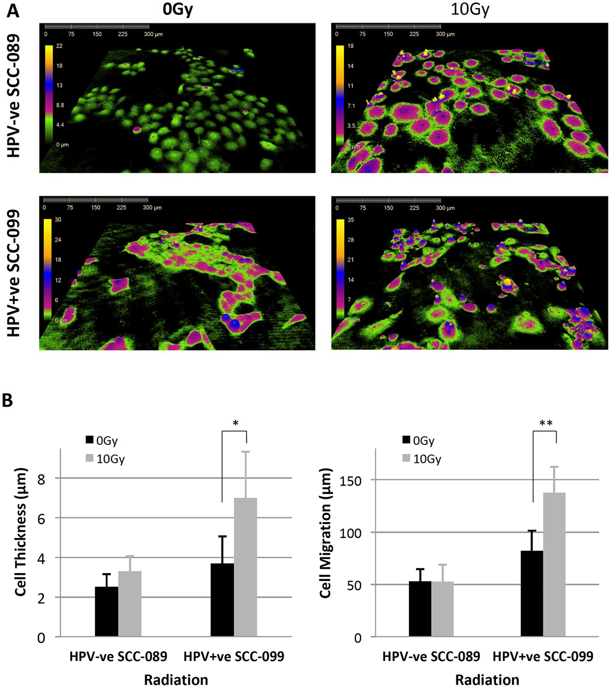 Radiation induced morphological changes on HPV-SCC-089 and HPV+SCC-099 by Holographic microscopy