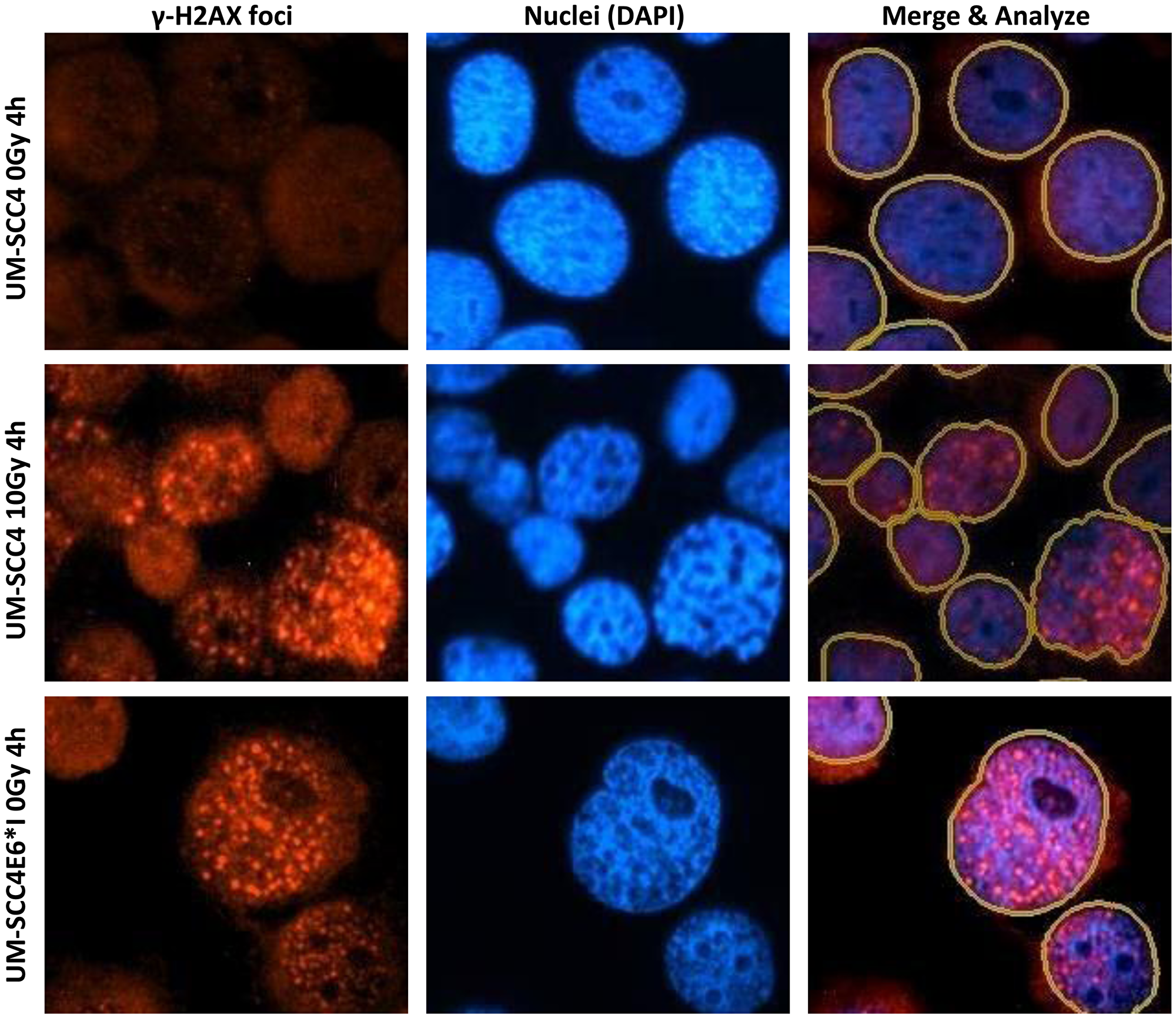 Examples of γ-H2AX foci staining of UM-SCC4 and UM-SCC4 E6*I cells