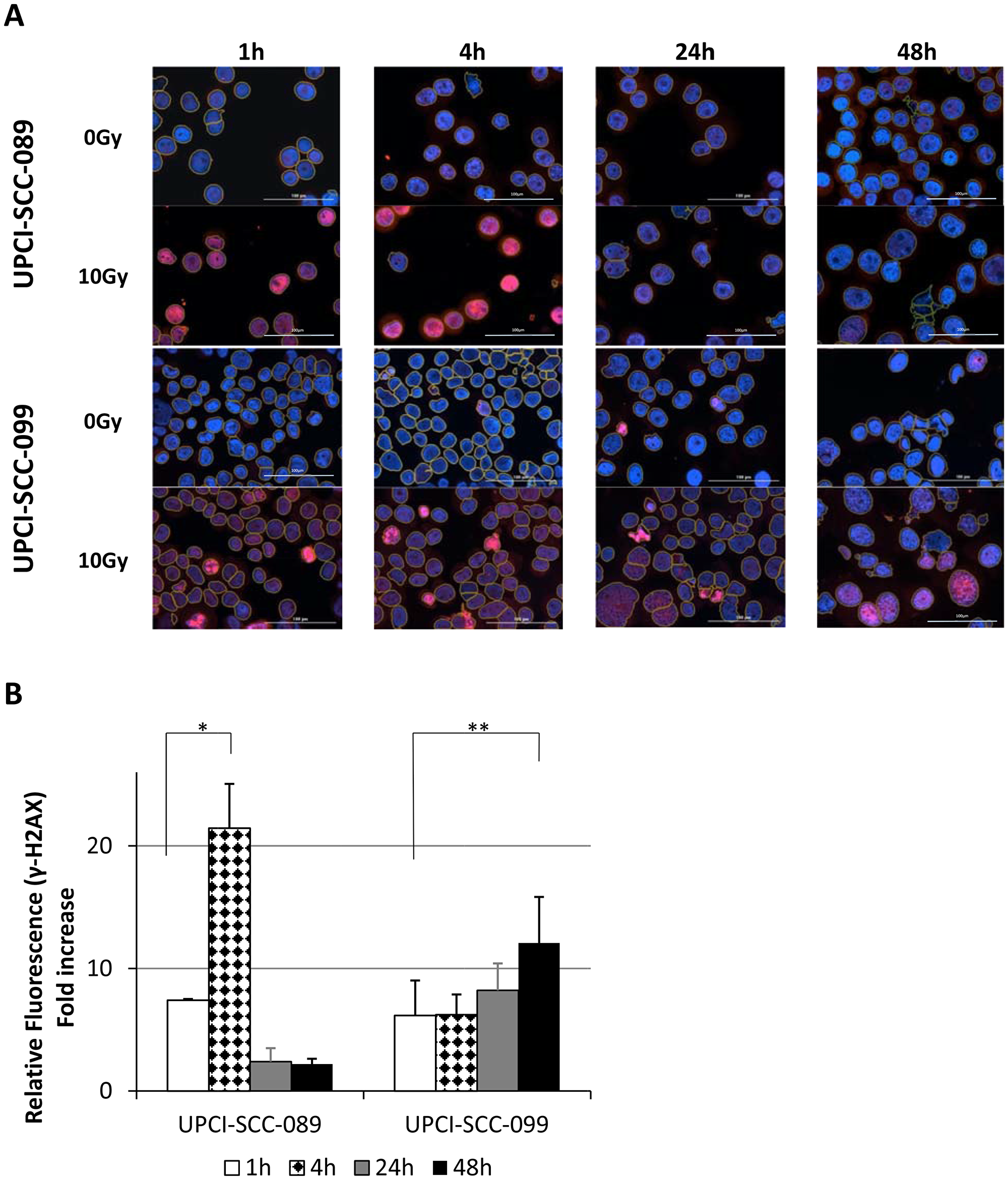 Radiation induced DNA damage measured by γ-H2AX foci formation at specified time point after 10 Gy