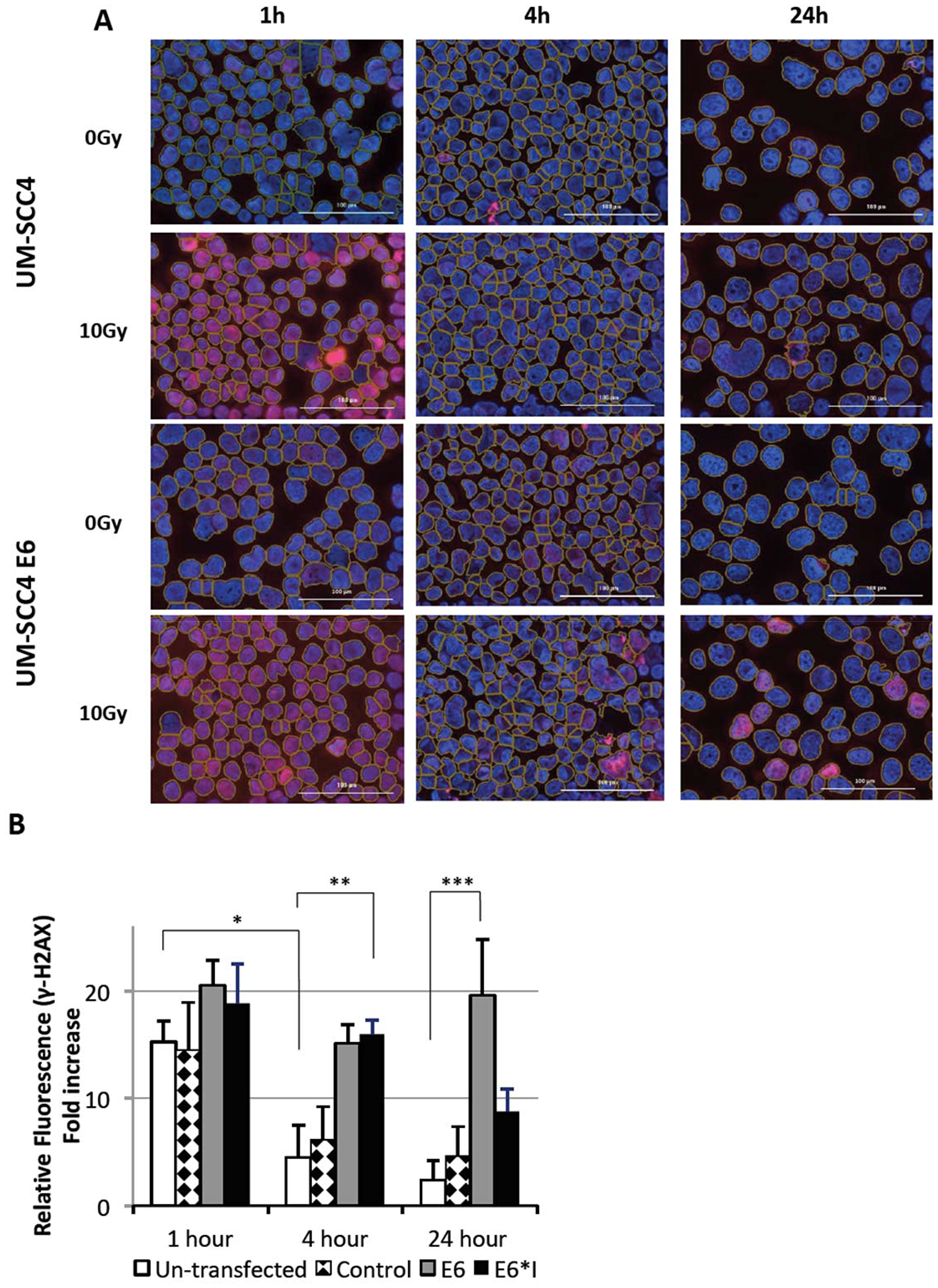 Radiation induced DNA damage measured by γ-H2AX foci formation at specified time point after 10 Gy irradiation