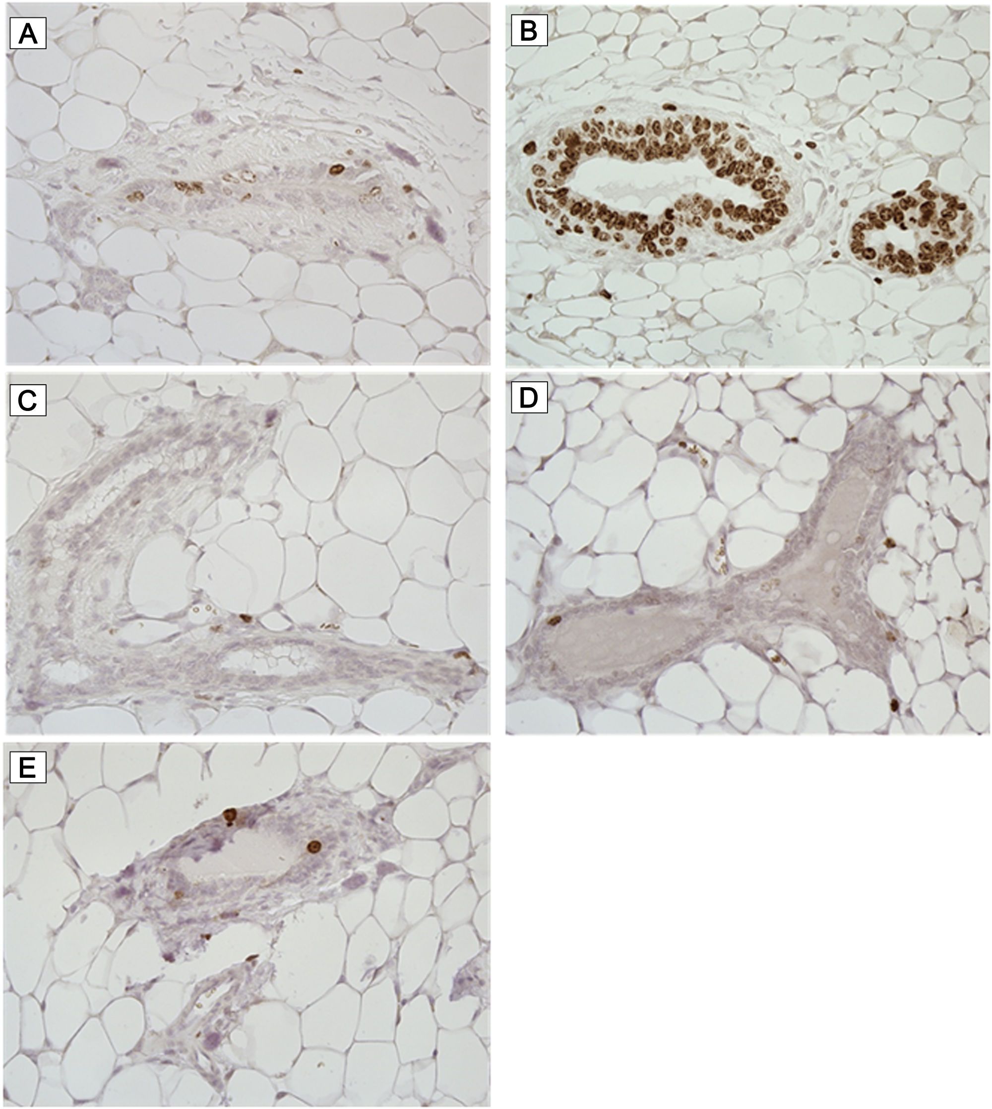 Ki-67 immunohistochemistry