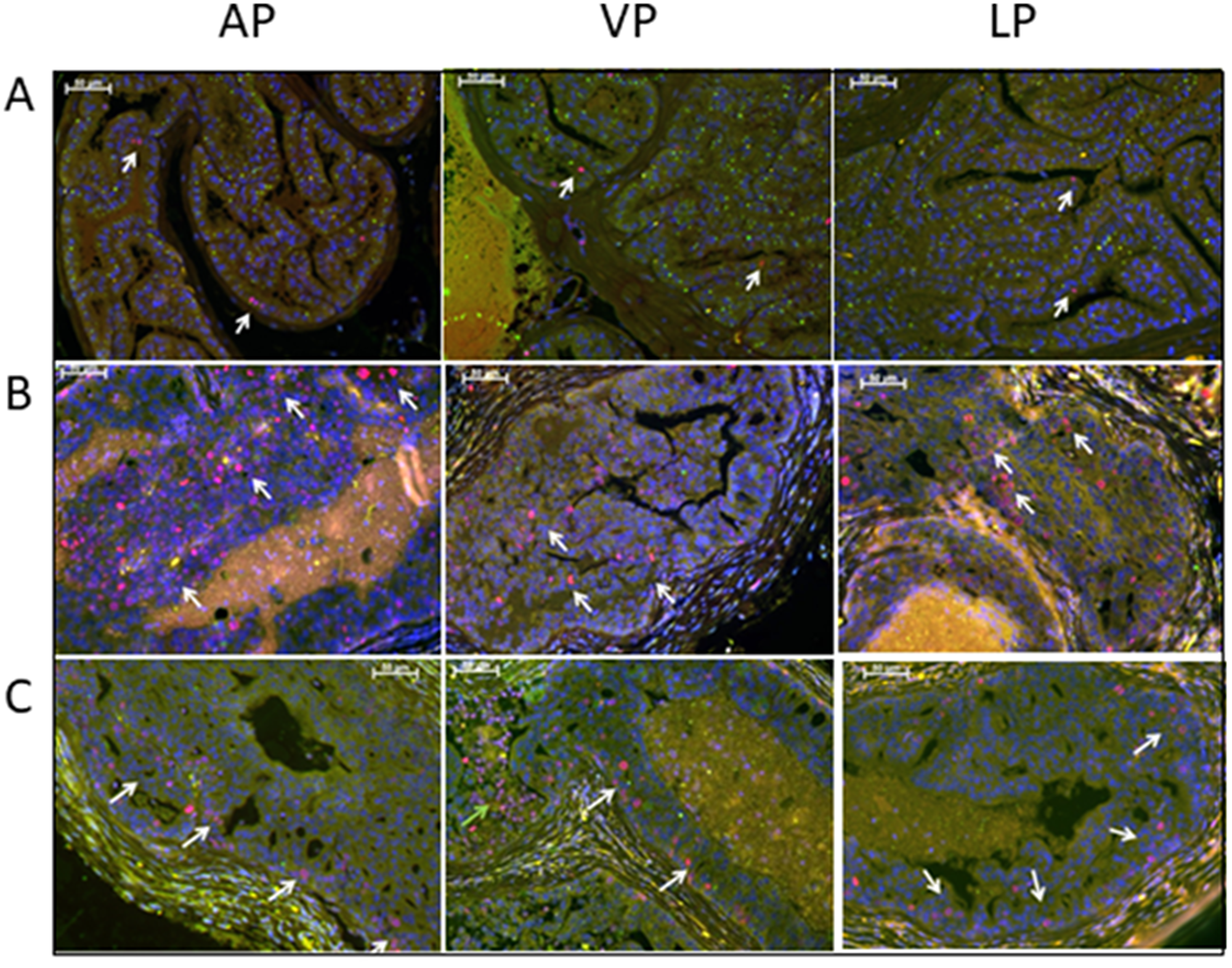 Treatment with low dose Rapatar reduces the number of proliferating cells in the prostate of PCa-prone psPten–/– mice