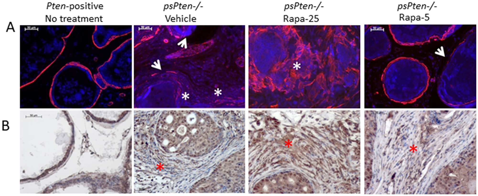 High dose (25 mg/kg) Rapatar treatment promotes development of reactive stroma and induces autophagy