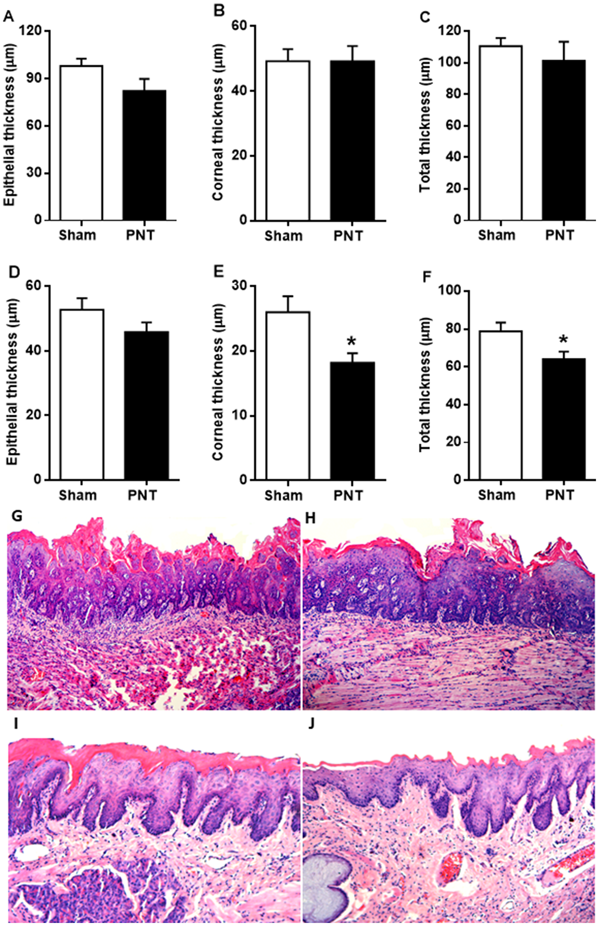 Non-tumor epithelial thickness adjacent to the tongue lesions derived from 4NQO treatment