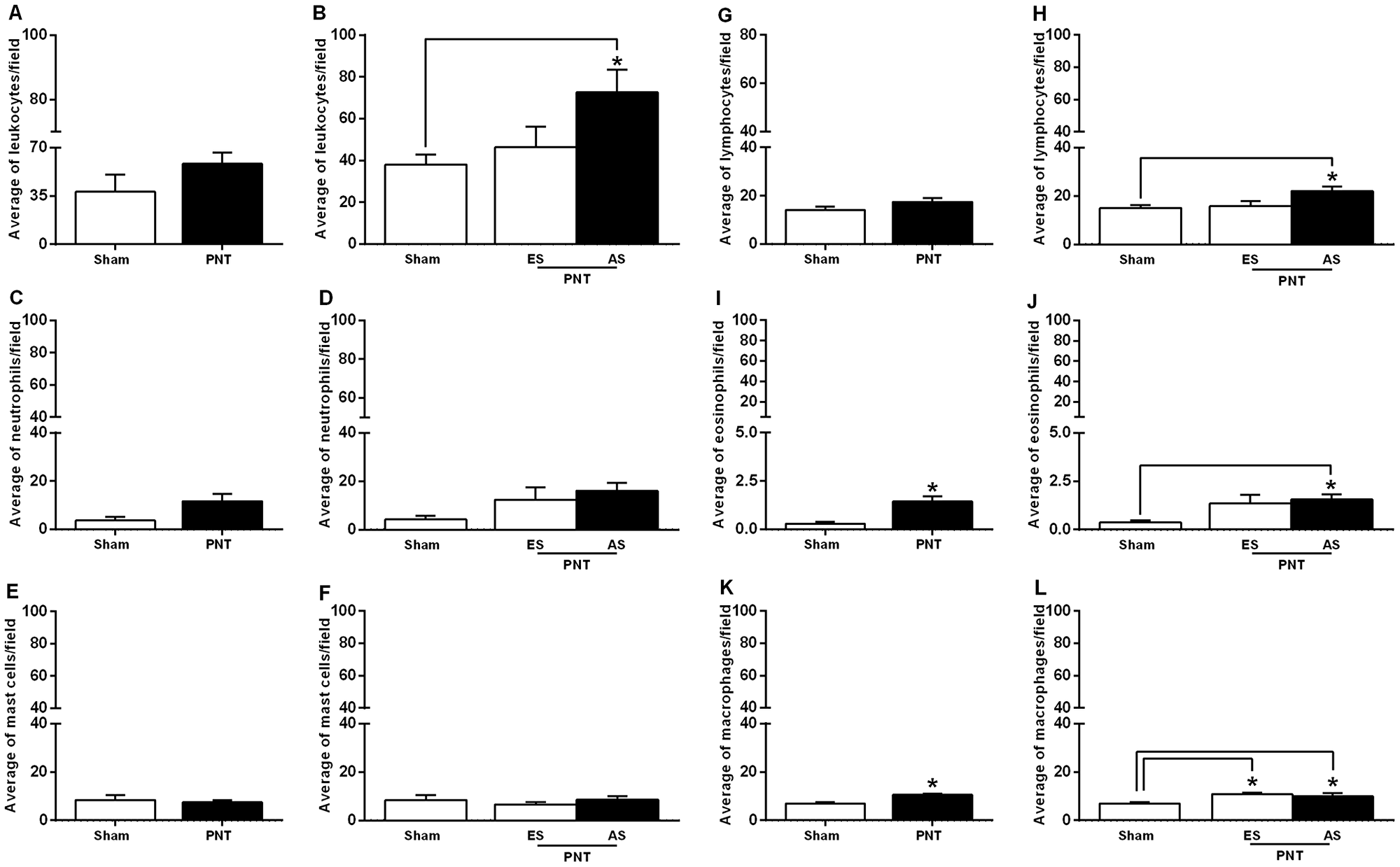 Inflammatory response in the tumor invasion front