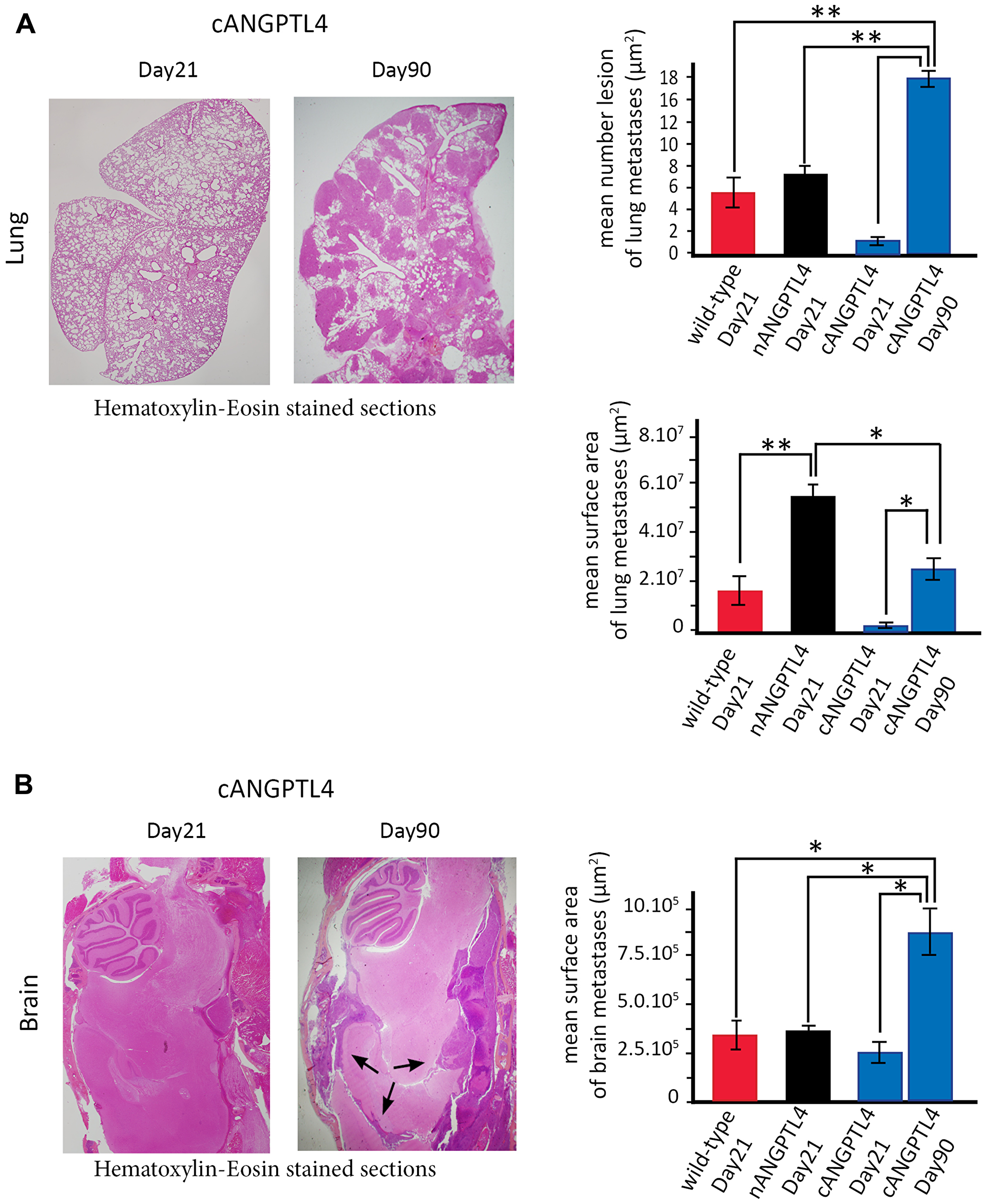 Mouse phenotype with cANGPTL4 4T1 cells at two different time-points, Day 21 and at the time of euthanasia