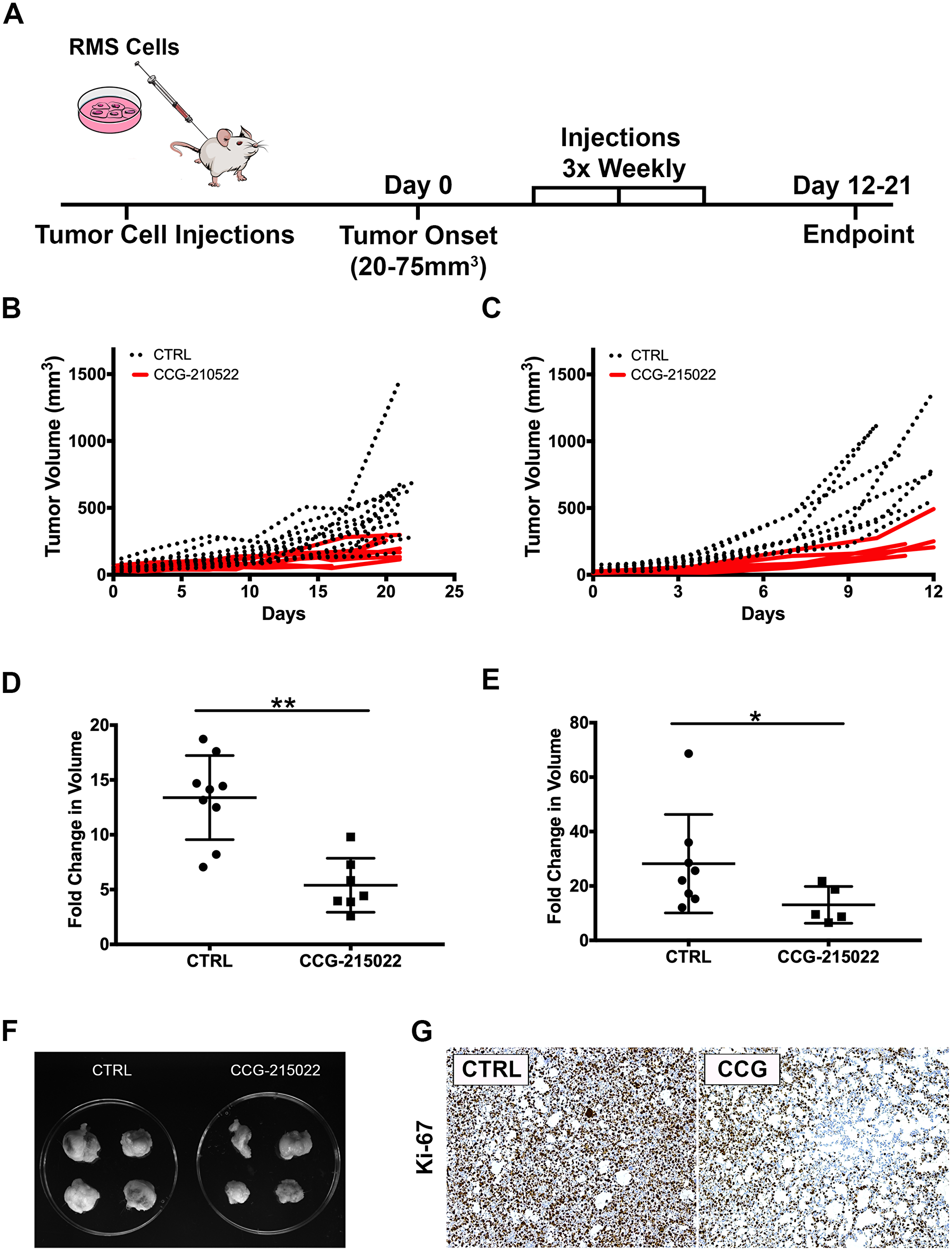 Treatment of RMS tumor with CCG-215022, a GRK5 inhibitor, reduces tumor growth