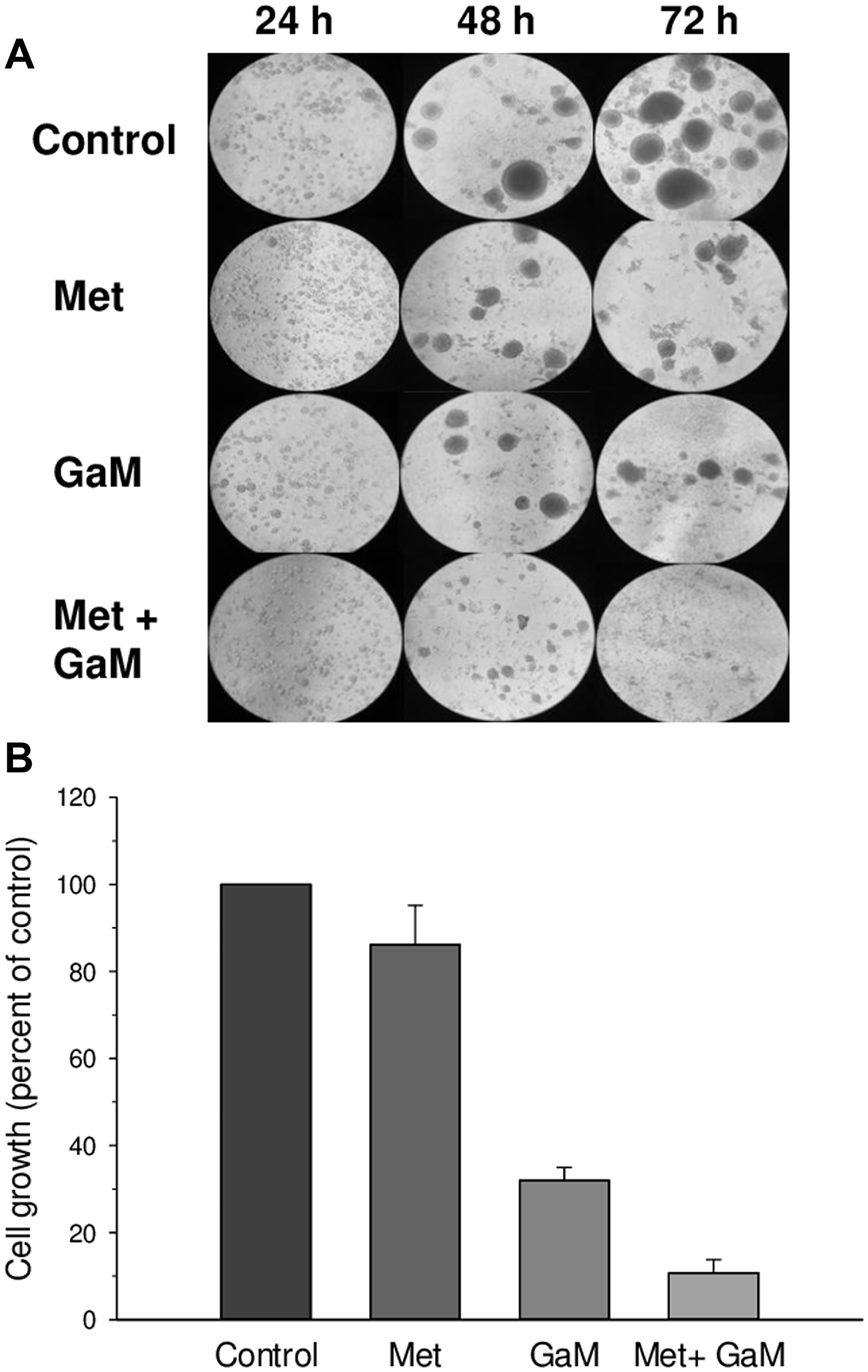 GaM and metformin inhibit the growth of glioblastoma stem cells (GSCs) (A). Photomicrographs of GSC-44 cell growth and neurosphere formation under different conditions. Control GSC-44 cells were plated as a single cell suspensions in culture and developed neurospheres over 48 – 72 h. Neurosphere formation was reduced in the presence of metformin (1 mmol/L) or GaM (50 μmol/L); neurosphere formation was completely blocked by the combination of metformin and GaM. (B) GSC-44 growth measured by MTT assay at 72 h.
