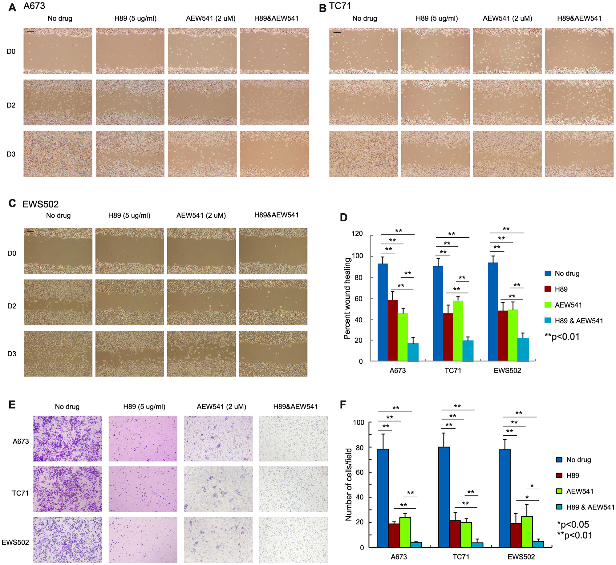 Simultaneous inhibition of PPP1R1A and IGF-1R pathways is more effective in limiting ES cell migration than single treatment