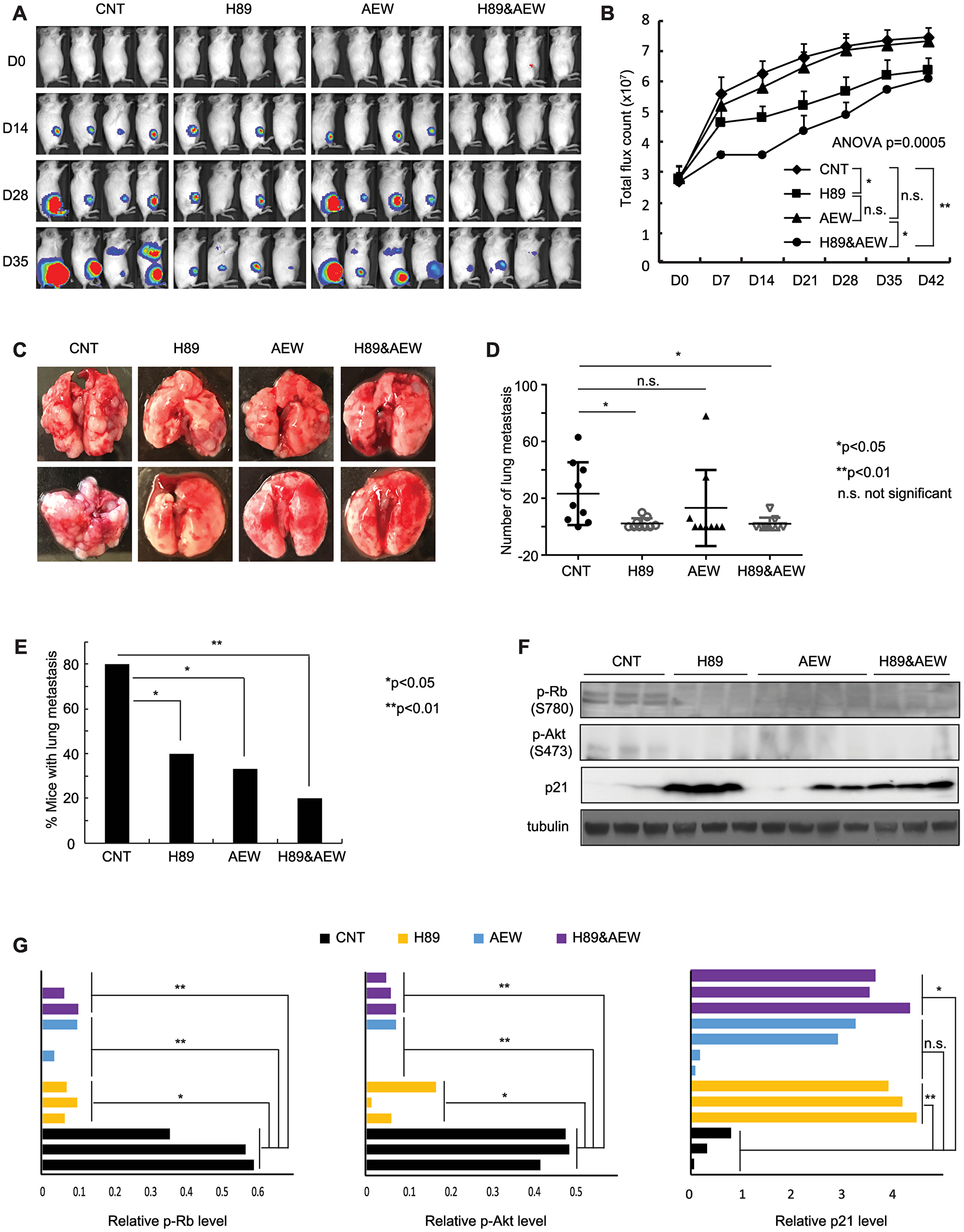 Combination of PPP1R1A and IGF-1R inhibition is more active in limiting ES tumor growth and metastasis than either individual treatment in an orthotopic xenograft mouse model