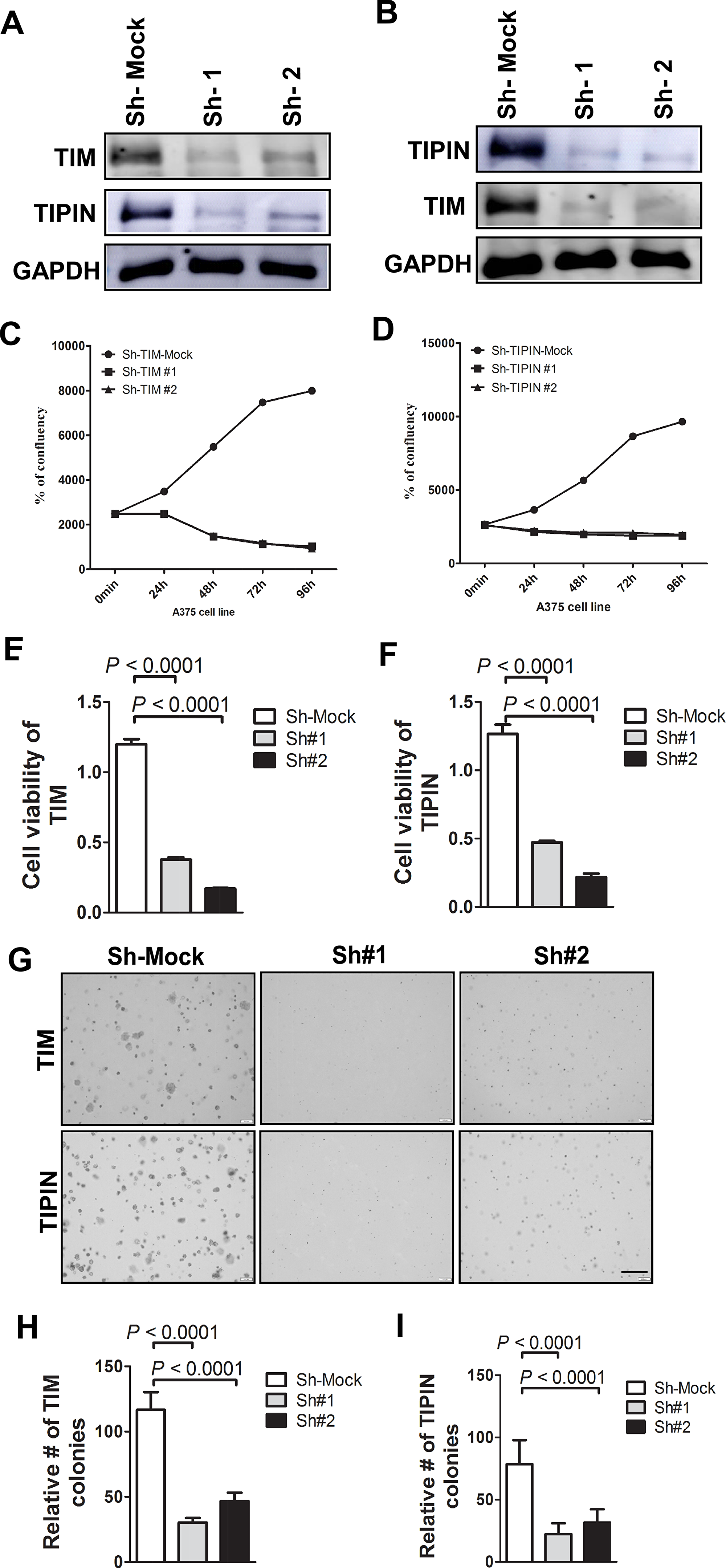 Knockdown of TIM/TIPIN inhibits melanoma cell proliferation