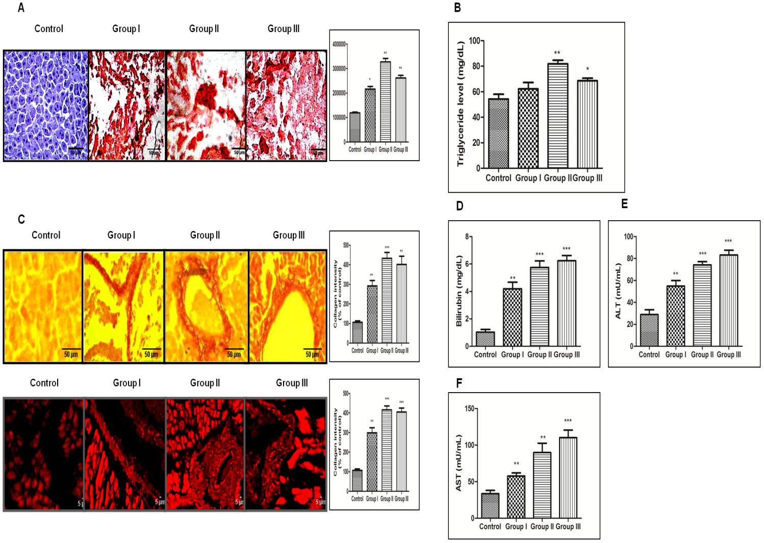DEN+CCl4 induced hepatocarcinogenesis was associated with increased lipidosis and fibrosis in hepatocytes