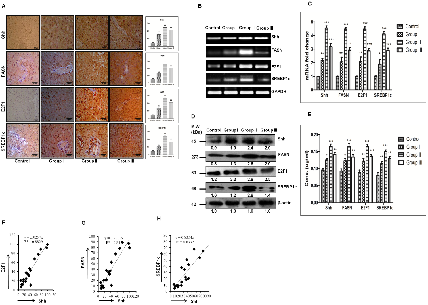 Strong positive correlation between the expression of SHH and lipogenic-molecules in DEN + CCl4 induced hepatocarcinogenesis model