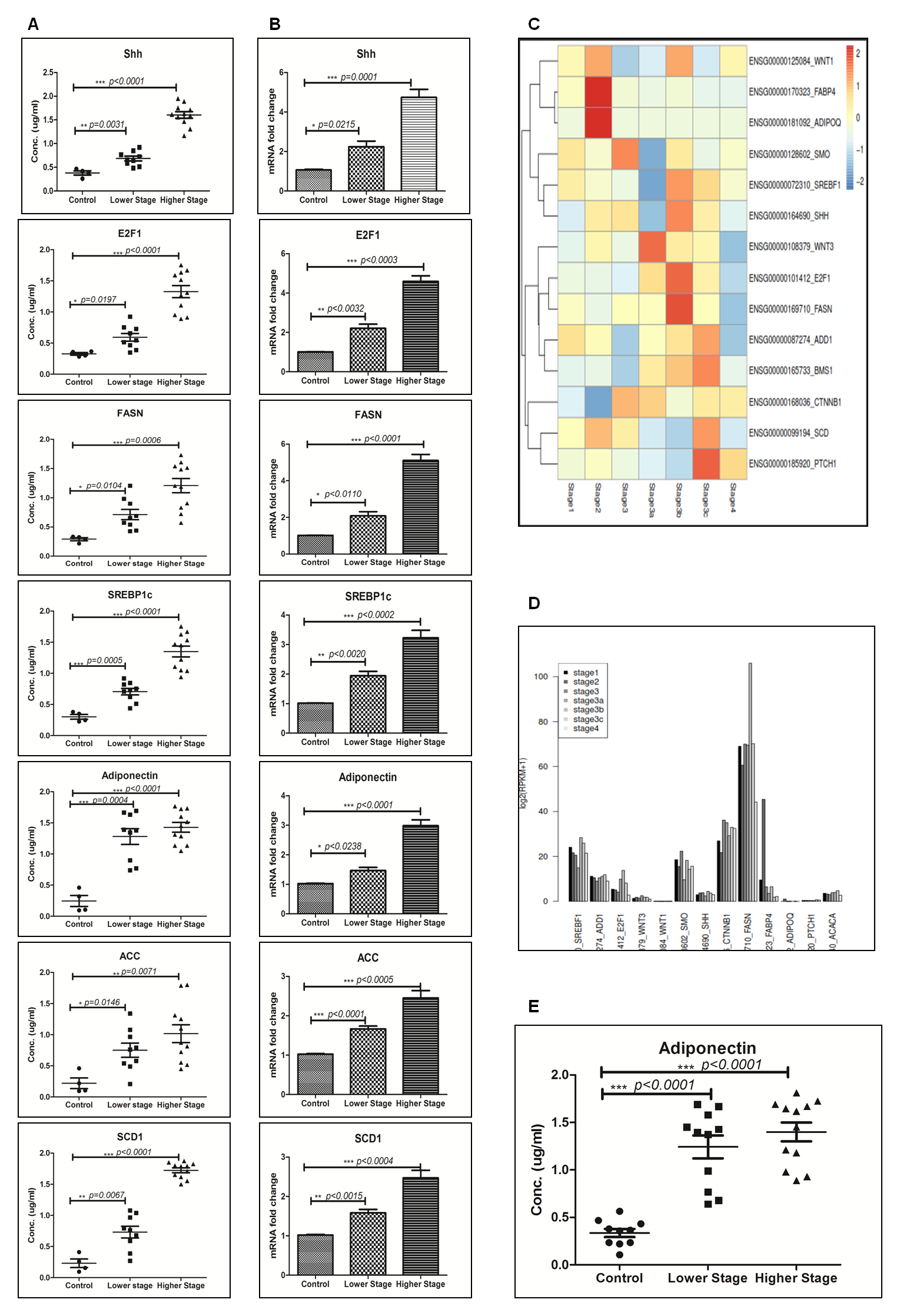 Enhanced expression of adiponectin and lipogenic-molecules in higher-stage hepatocellular carcinoma patients’ biospecimens