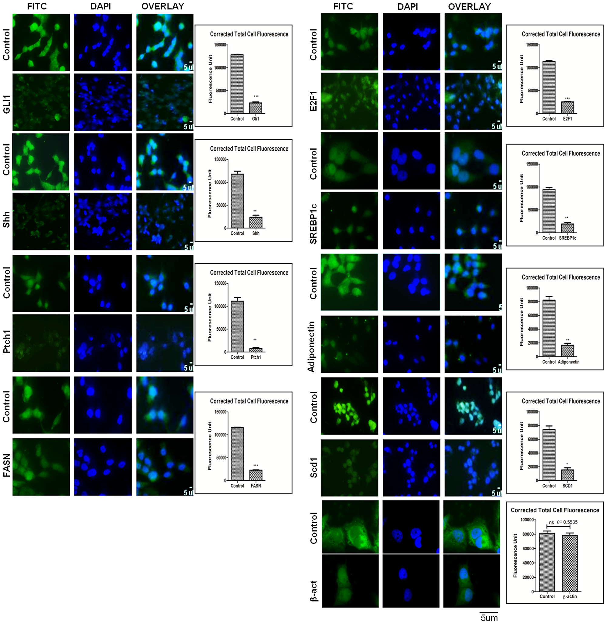 Expression level of Hh and lipogenic molecules in hepatocellular carcinoma cell-line in the presence of KC