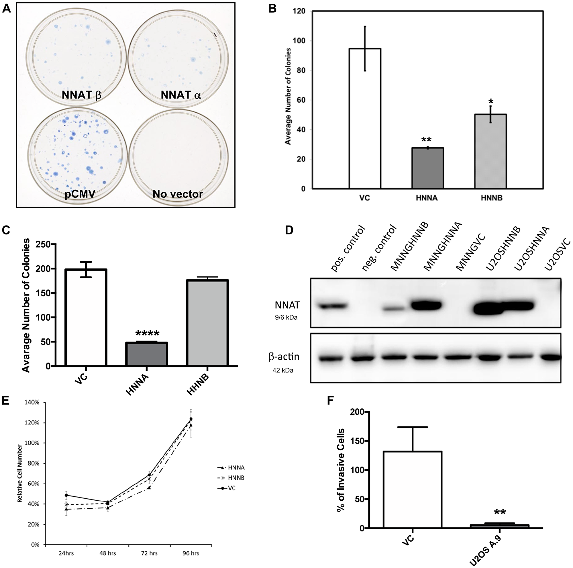 Enforced expression of NNAT in human osteosarcoma cells inhibits clonogenicity and migration, but does not slow proliferation