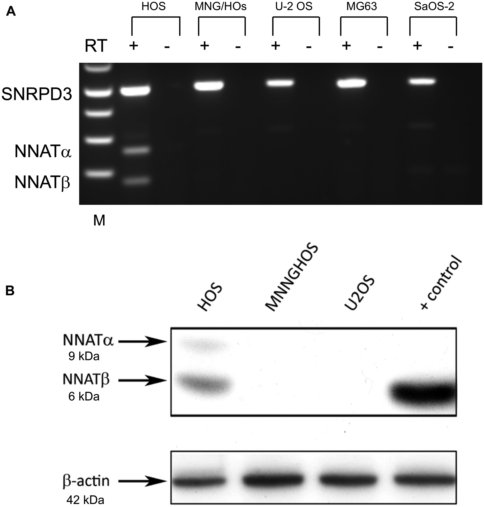 NNAT expression is detected in an osteosarcoma cell line exhibiting the normal imprinted hemimethylation pattern but not in cell lines exhibiting NNAT hypermethylation