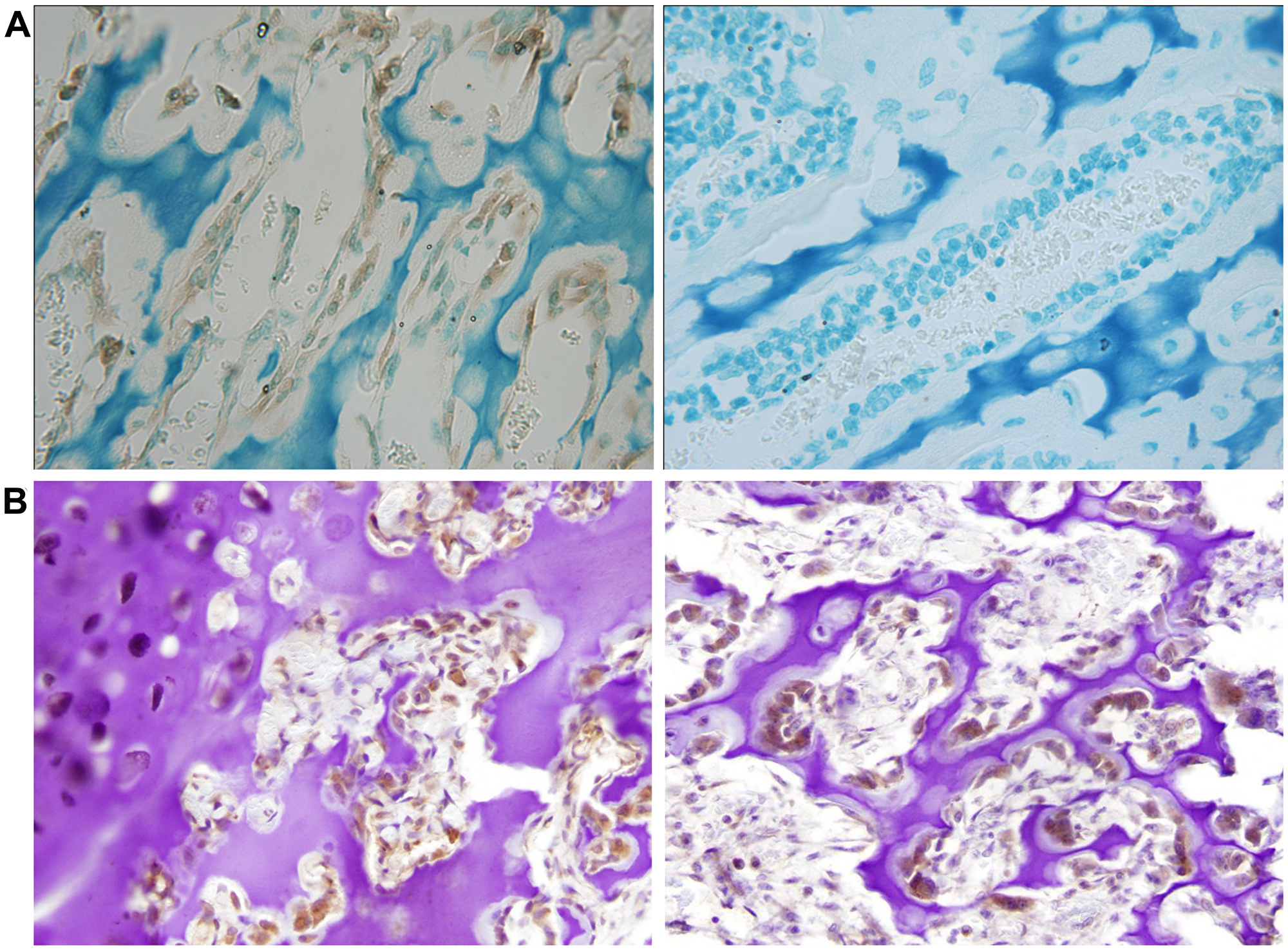 Neuronatin protein expression is detectable in normal bone and cartilage tissues