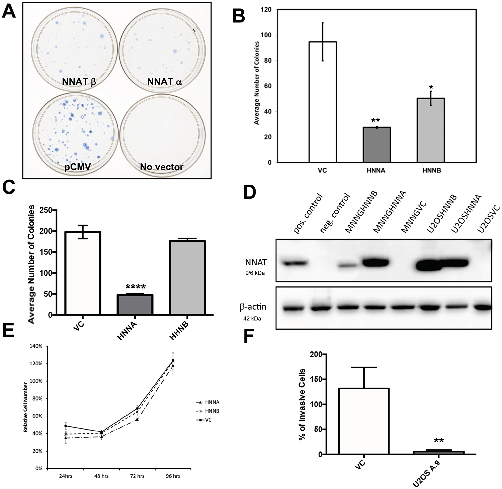 Enforced expression of NNAT in human osteosarcoma cells inhibits clonogenicity and migration, but does not slow proliferation