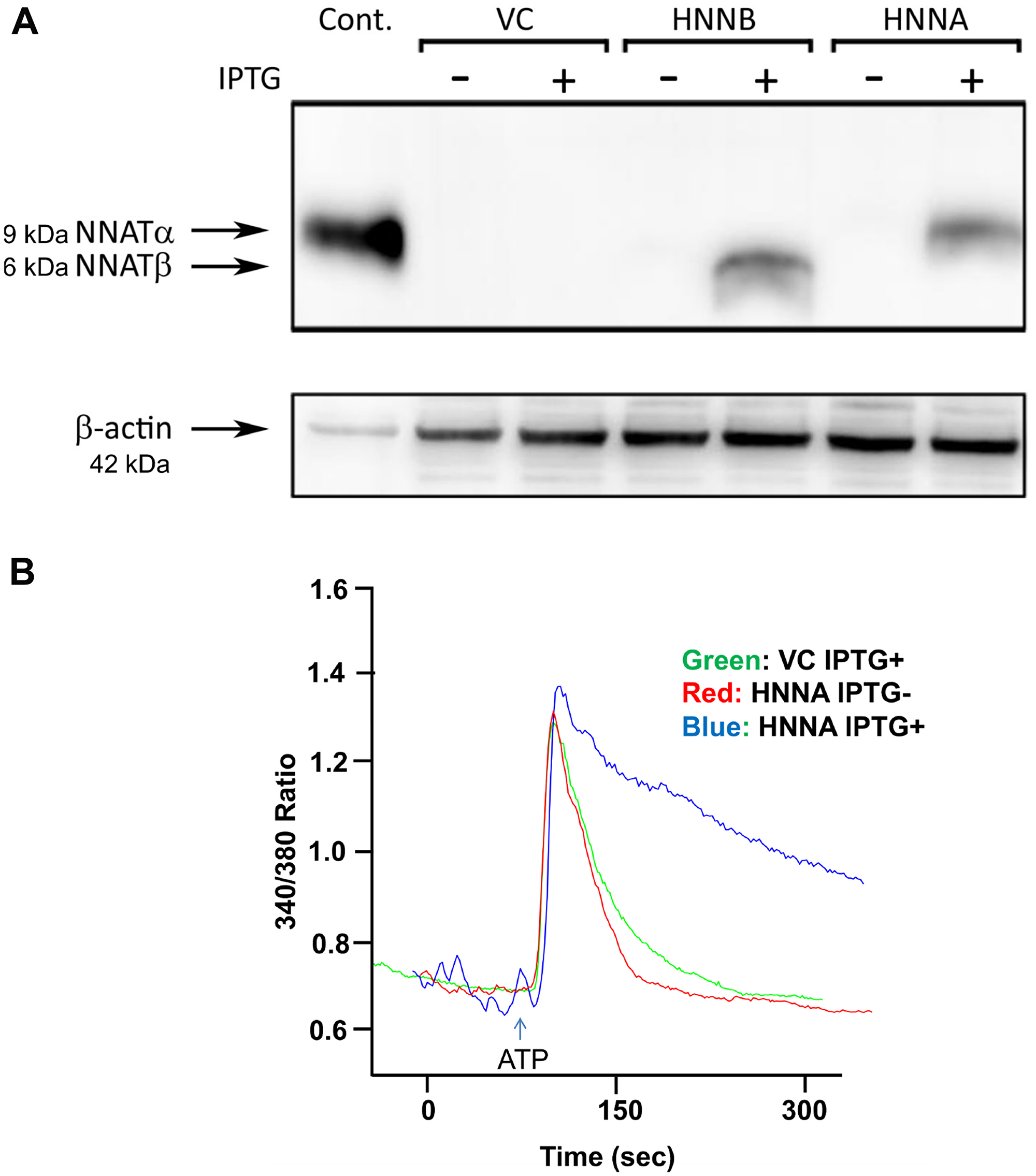 NNAT expression is associated with attenuated decay of [Ca2+]i following ATP-induced release of calcium stores in human osteosarcoma cells