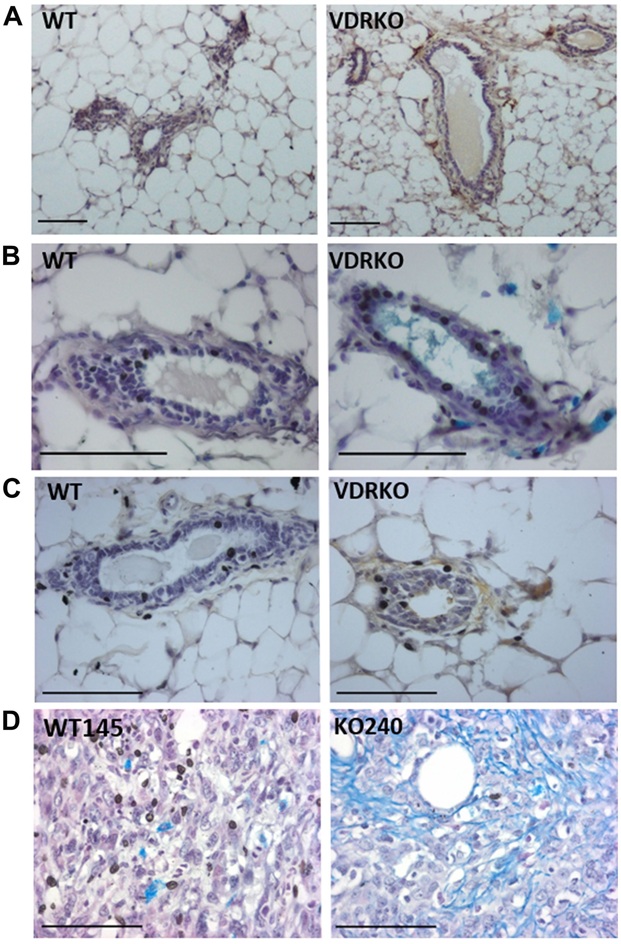 HAS2, glycosaminoglycans and HA localization in wild-type and VDRKO mice