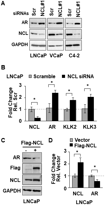 NCL suppresses AR expression