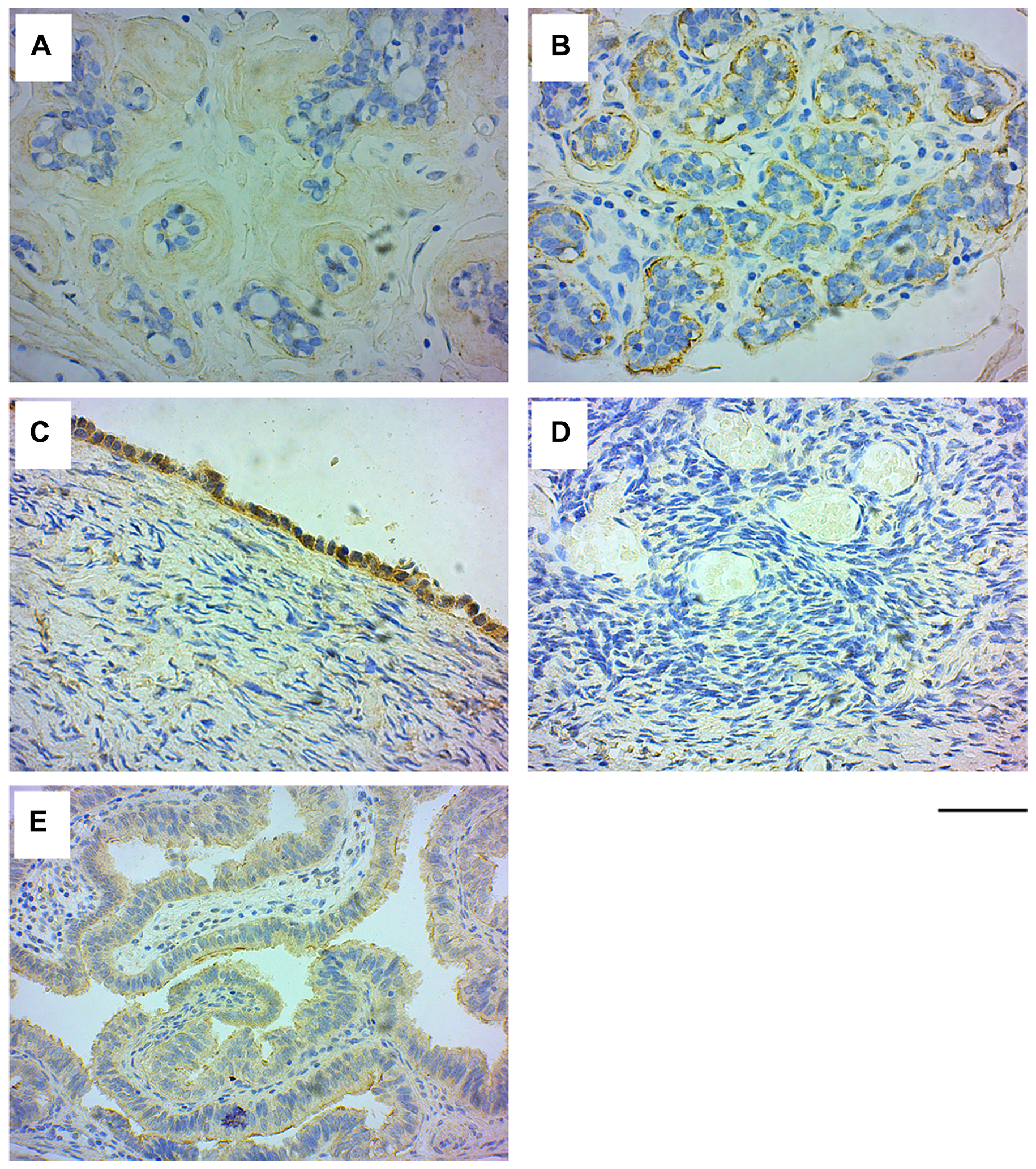 GRB7 expression in normal breast and ovarian tissues