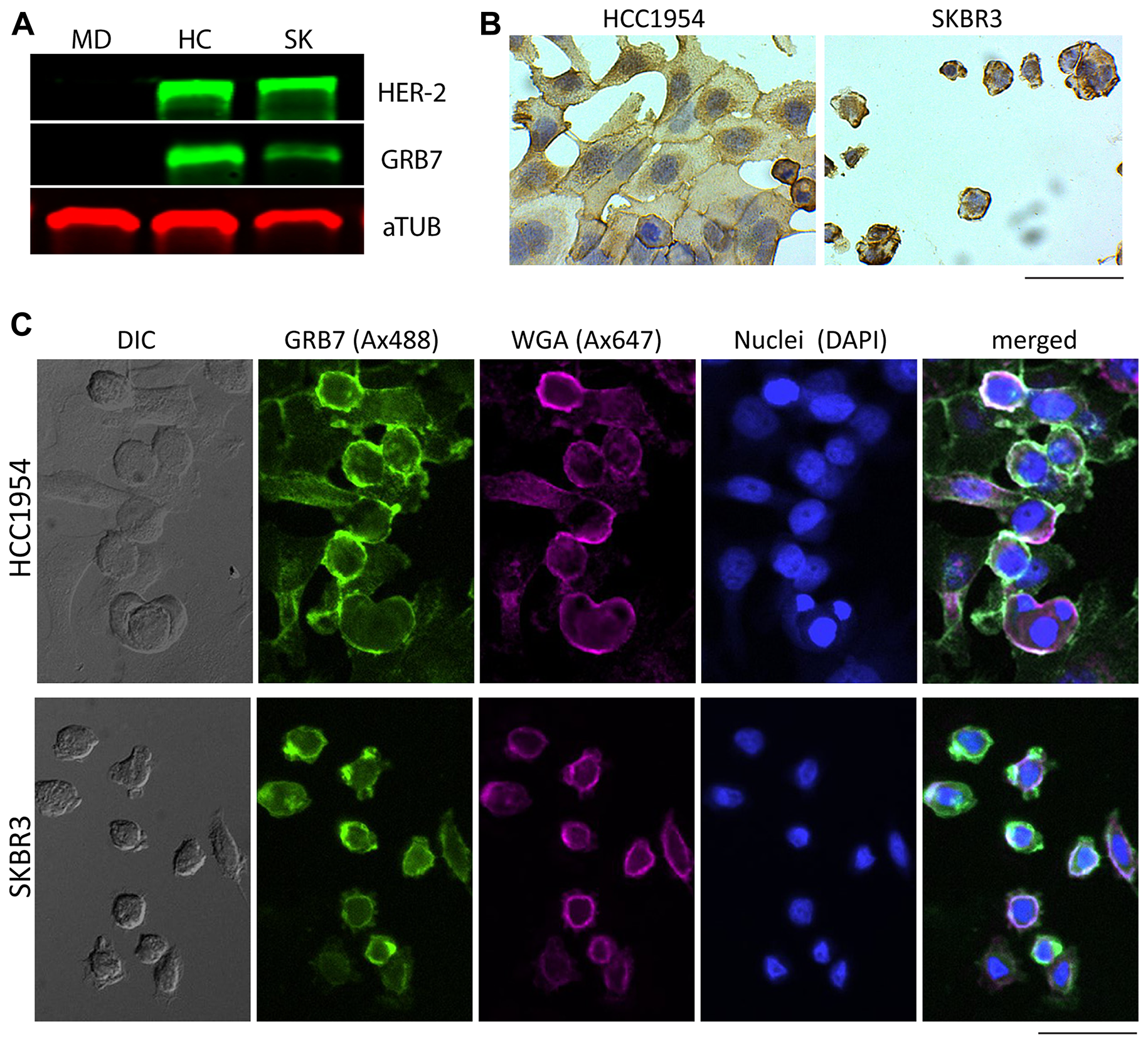 GRB7 expression levels and localization of breast cancer cell lines (MDA-MB-231, HCC1954, and SKBR3)
