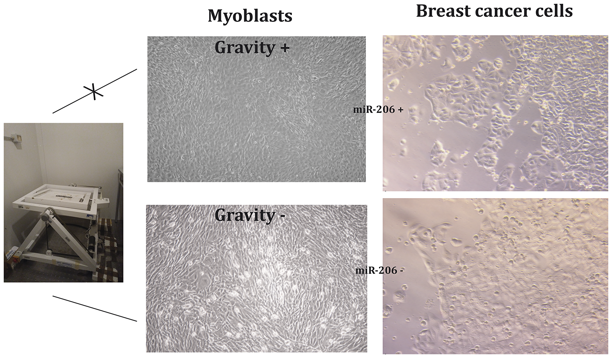 Myoblasts stimulated by gravity (G) release miRNA-microvesicles inhibiting breast cancer cell growth