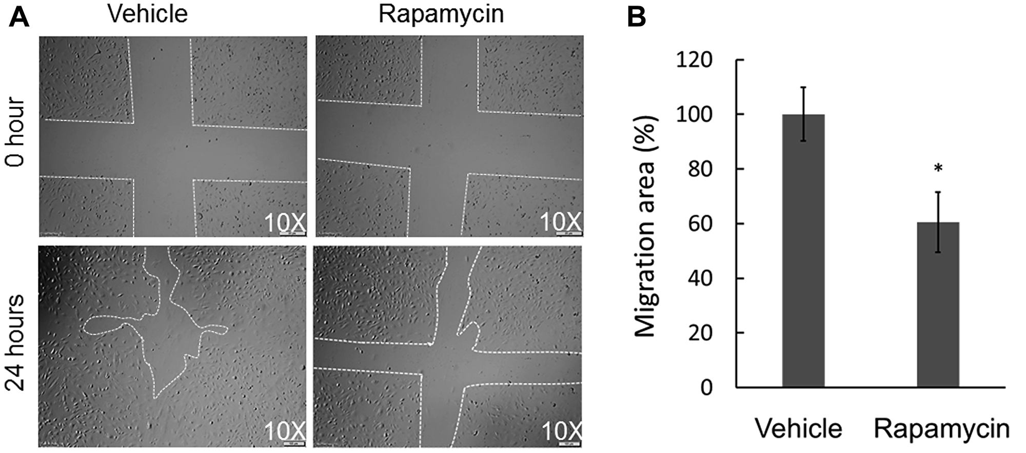 Effect of rapamycin on the in vitro wound healing ability of COS-33 cells