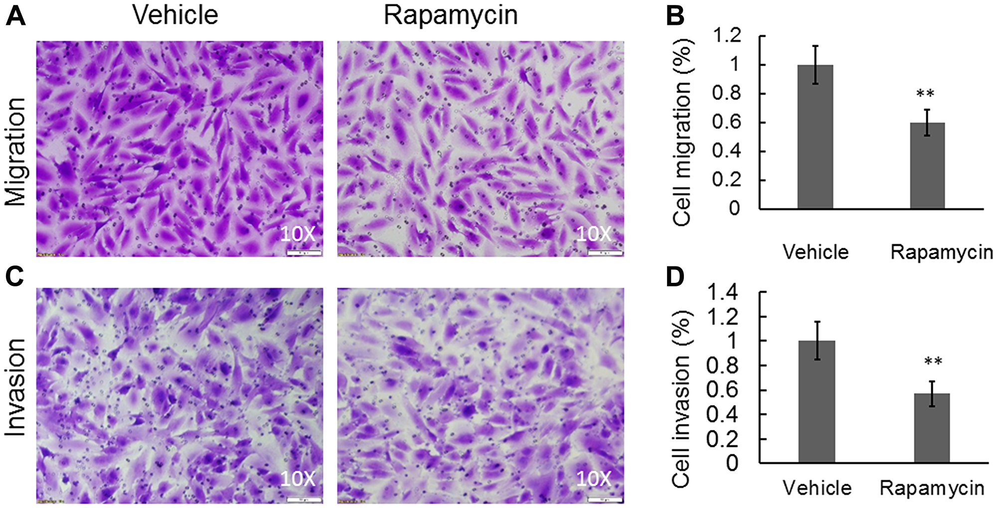 Rapamycin was able to significantly inhibit cell migration and invasion in a Boyden chamber-based system