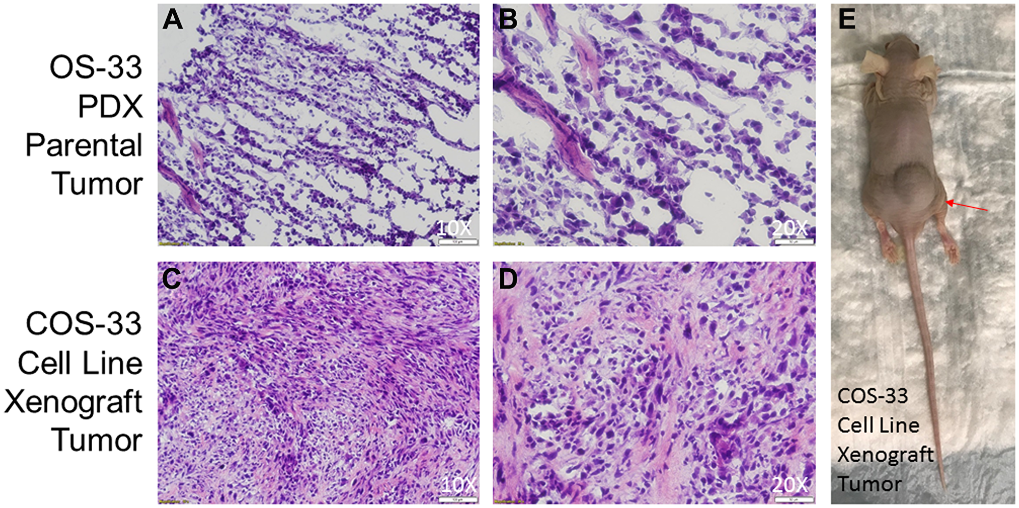 Photographs of histological sections of COS-33 tumors and the xenograft mouse