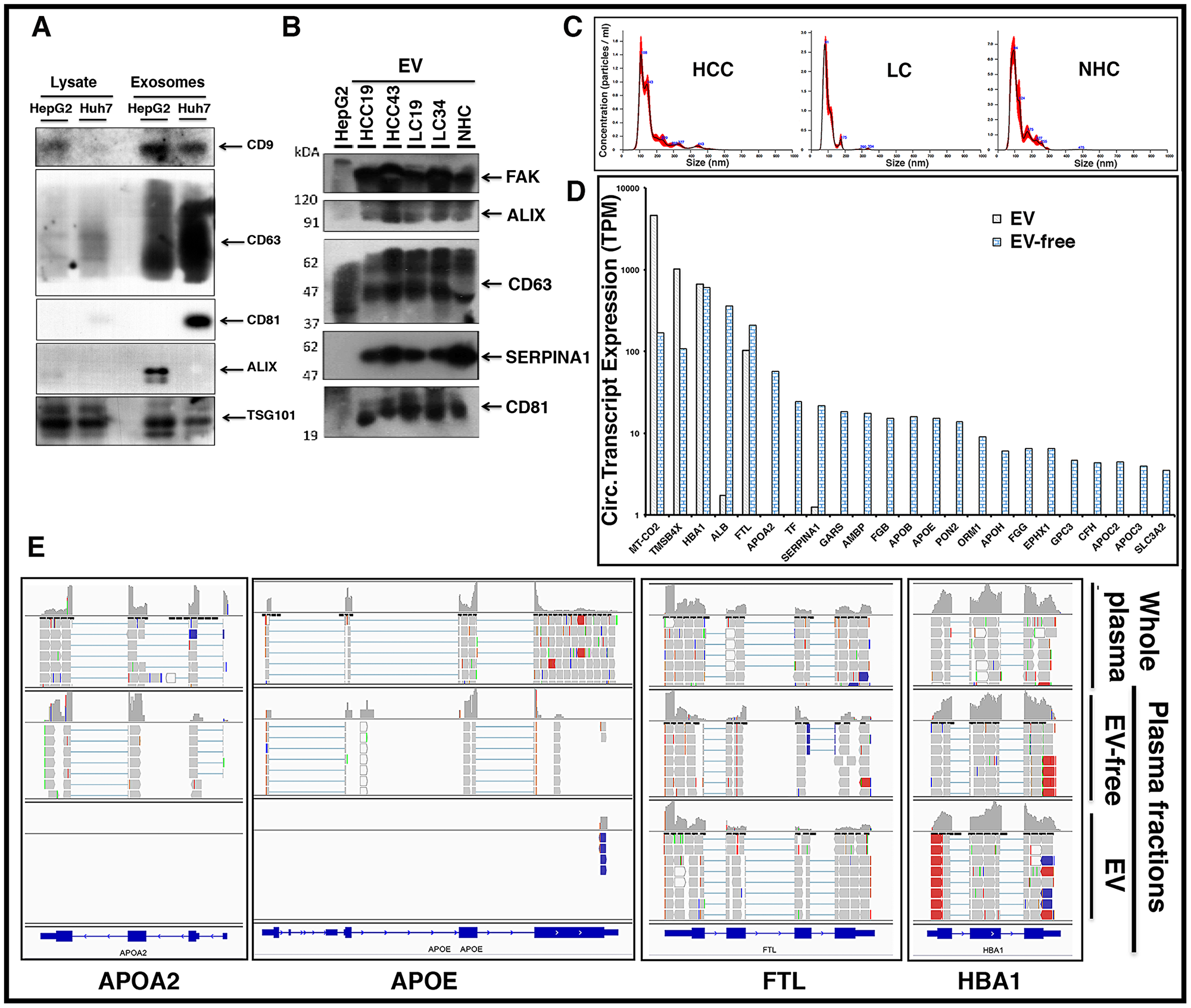 Circulating liver derived transcripts predominantly exist outside extracellular vesicles (EVs) in the plasma of HCC patients