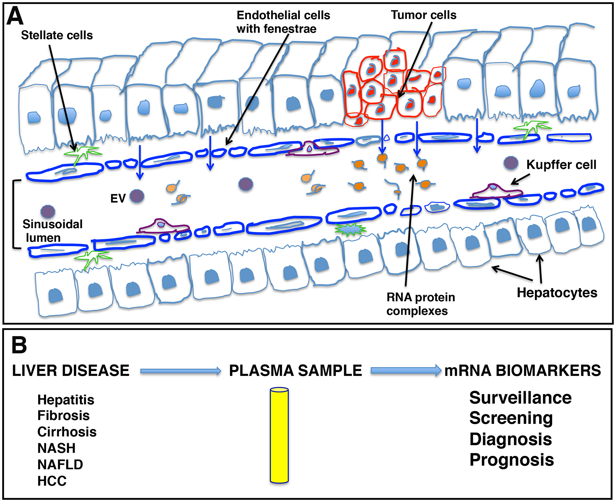 Schematic representation of liver sinusoids and loose architecture of liver endothelium