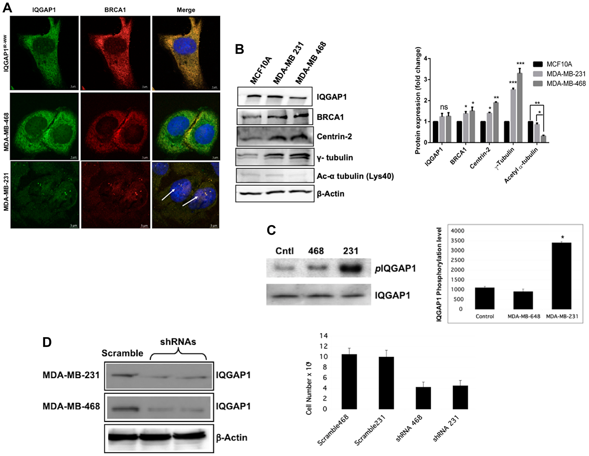 Differential expression and/or spatial distribution of IQGAP1, BRCA1 and centrosome markers in different Triple Negative Breast Cancer (TNBC) cell lines