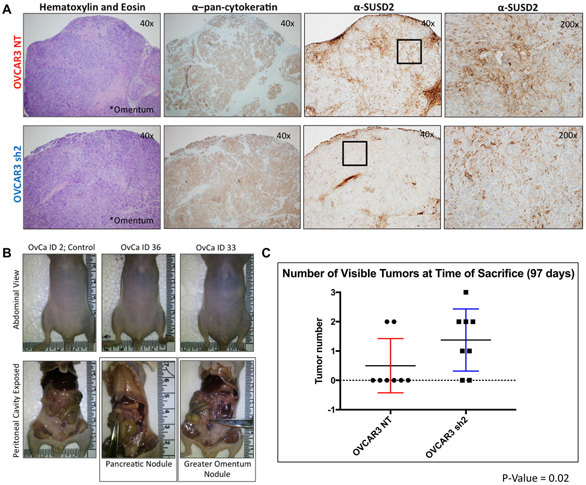 SUSD2-KD mice from Experimental Arm 1 had increased tumor formation