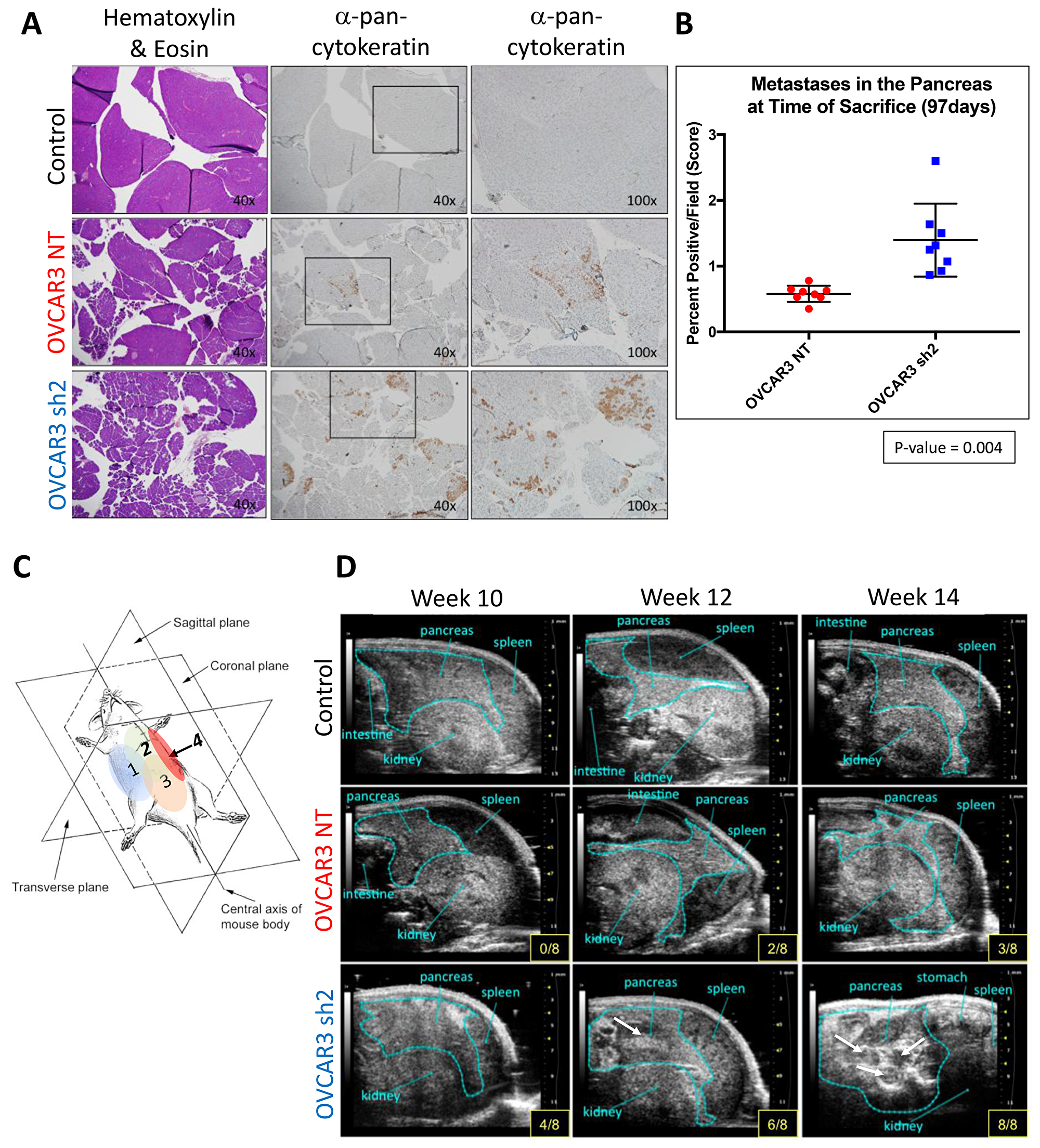 SUSD2-KD mice showed increased pancreatic tumor burden at initial time of sacrifice