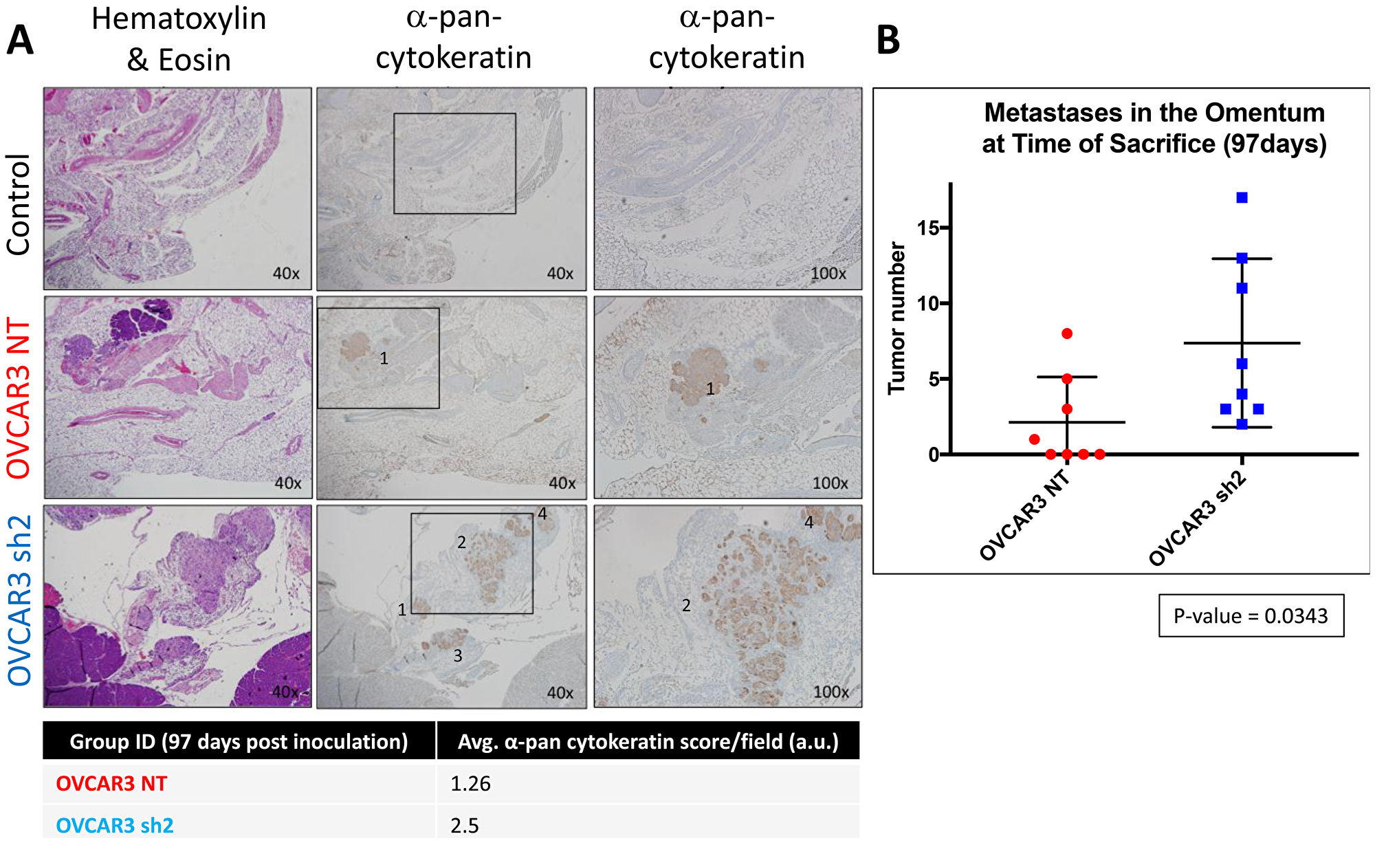 SUSD2-KD mice showed increased tumor burden in the omentum at initial time of sacrifice