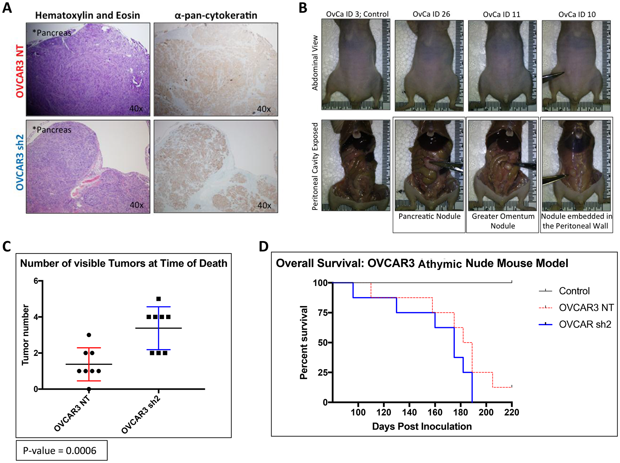 OVCAR3-NT mice lived significantly longer than OVCAR3 SUSD2-KD mice