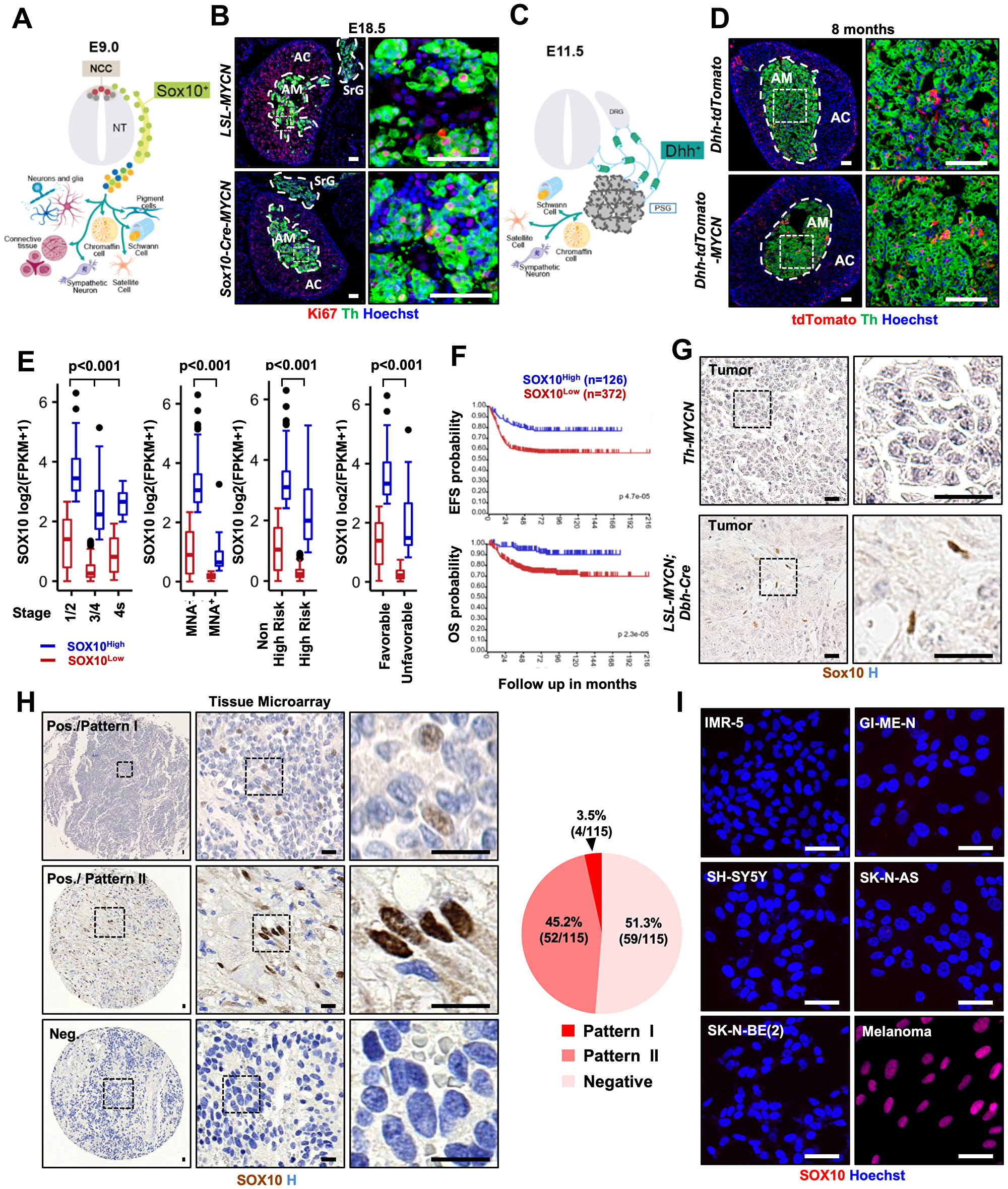 Targeting MYCN to Sox10+ NCSCs does not lead to NB formation and SOX10 is predominantly expressed in Schwannian stromal compartment