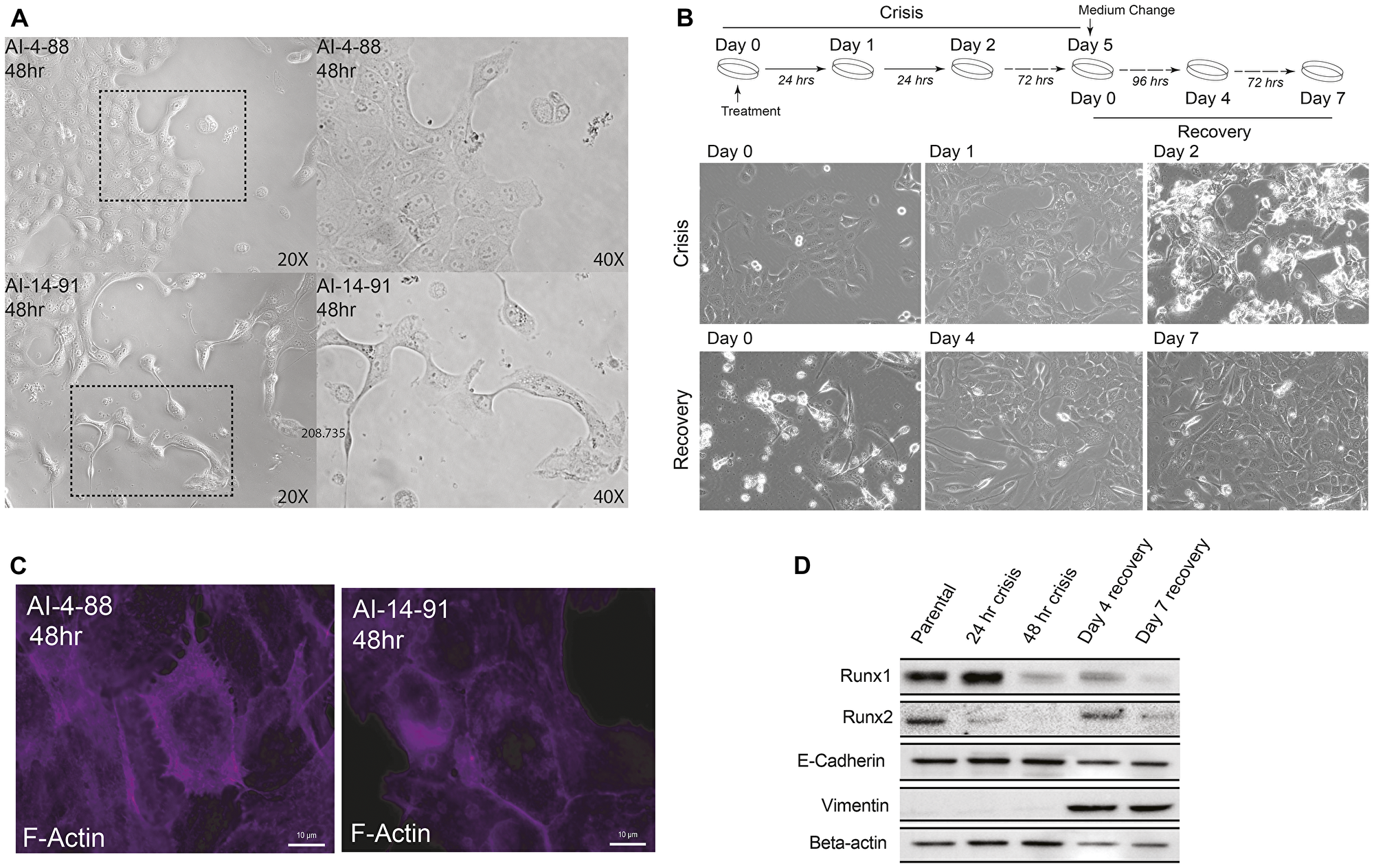 Disrupting transcriptional activity of the RUNX1-CBF Complex in MCF10A cells leads to a transformed cellular phenotype and EMT
